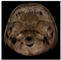 Jcm 11 04887 i003 Jcm 11 04887 i003