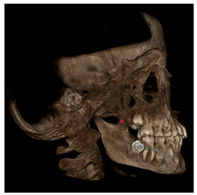 Jcm 11 04887 i005 Jcm 11 04887 i005