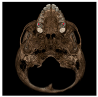 Jcm 11 04887 i007 Jcm 11 04887 i007