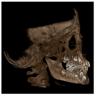 Jcm 11 04887 i008 Jcm 11 04887 i008