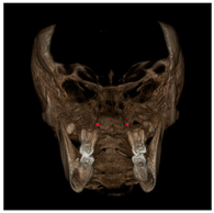 Jcm 11 04887 i009 Jcm 11 04887 i009