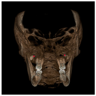 Jcm 11 04887 i010 Jcm 11 04887 i010