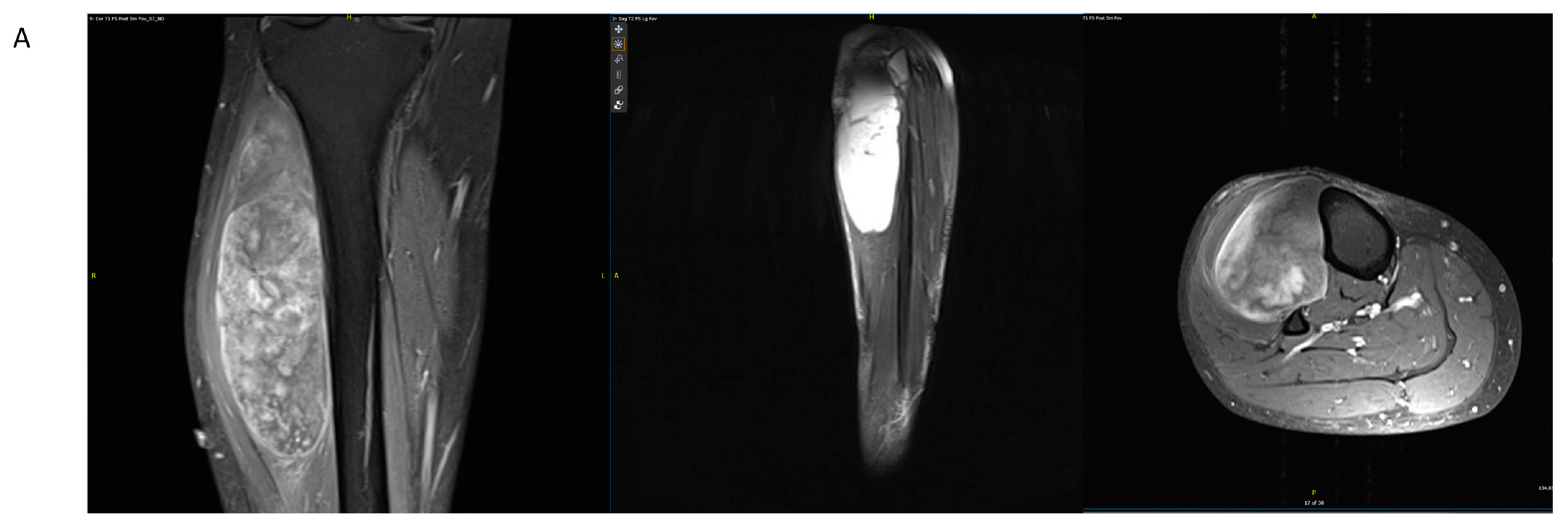 Jcm 11 04959 g002a Jcm 11 04959 g002a