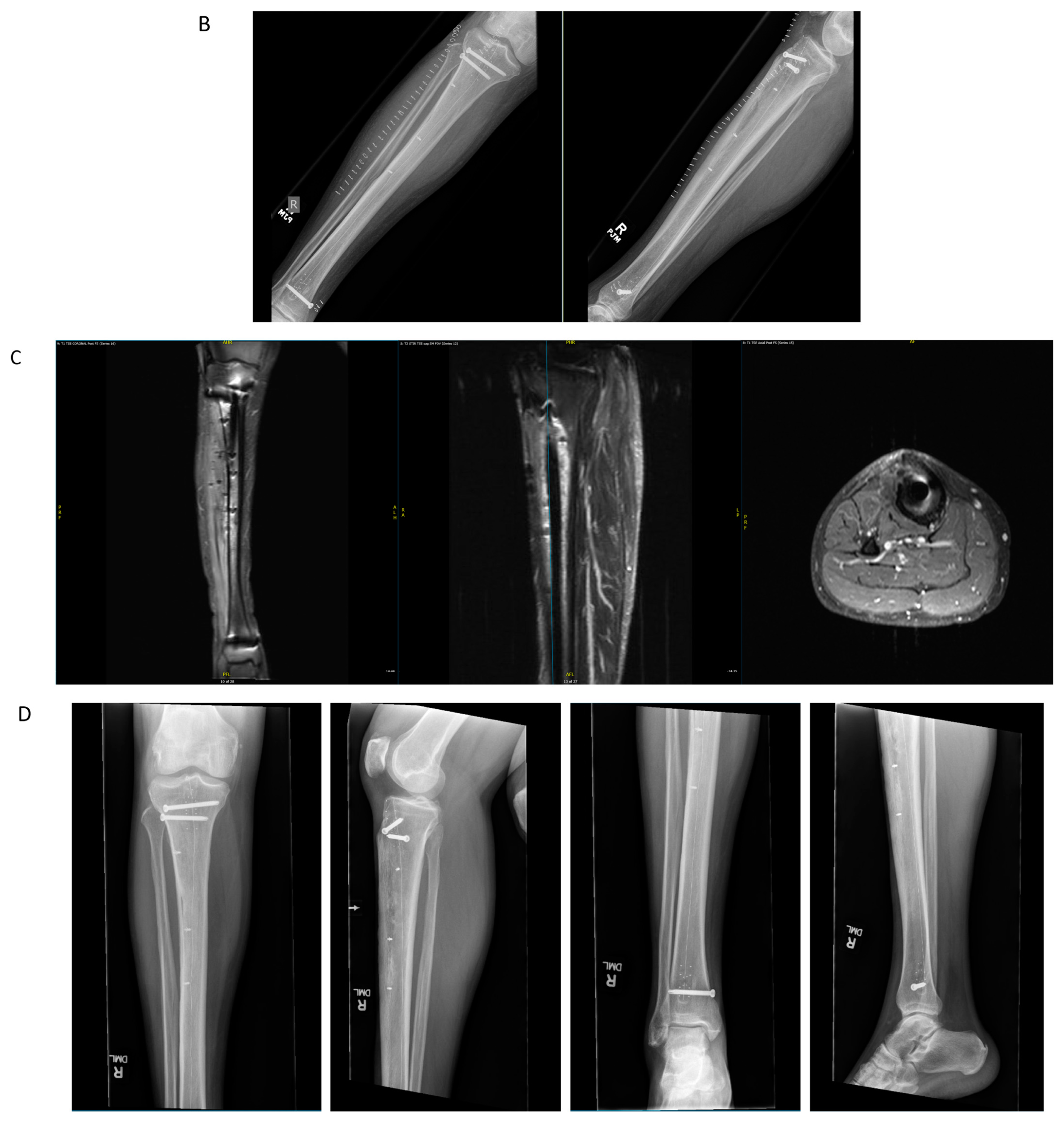 Jcm 11 04959 g002b Jcm 11 04959 g002b