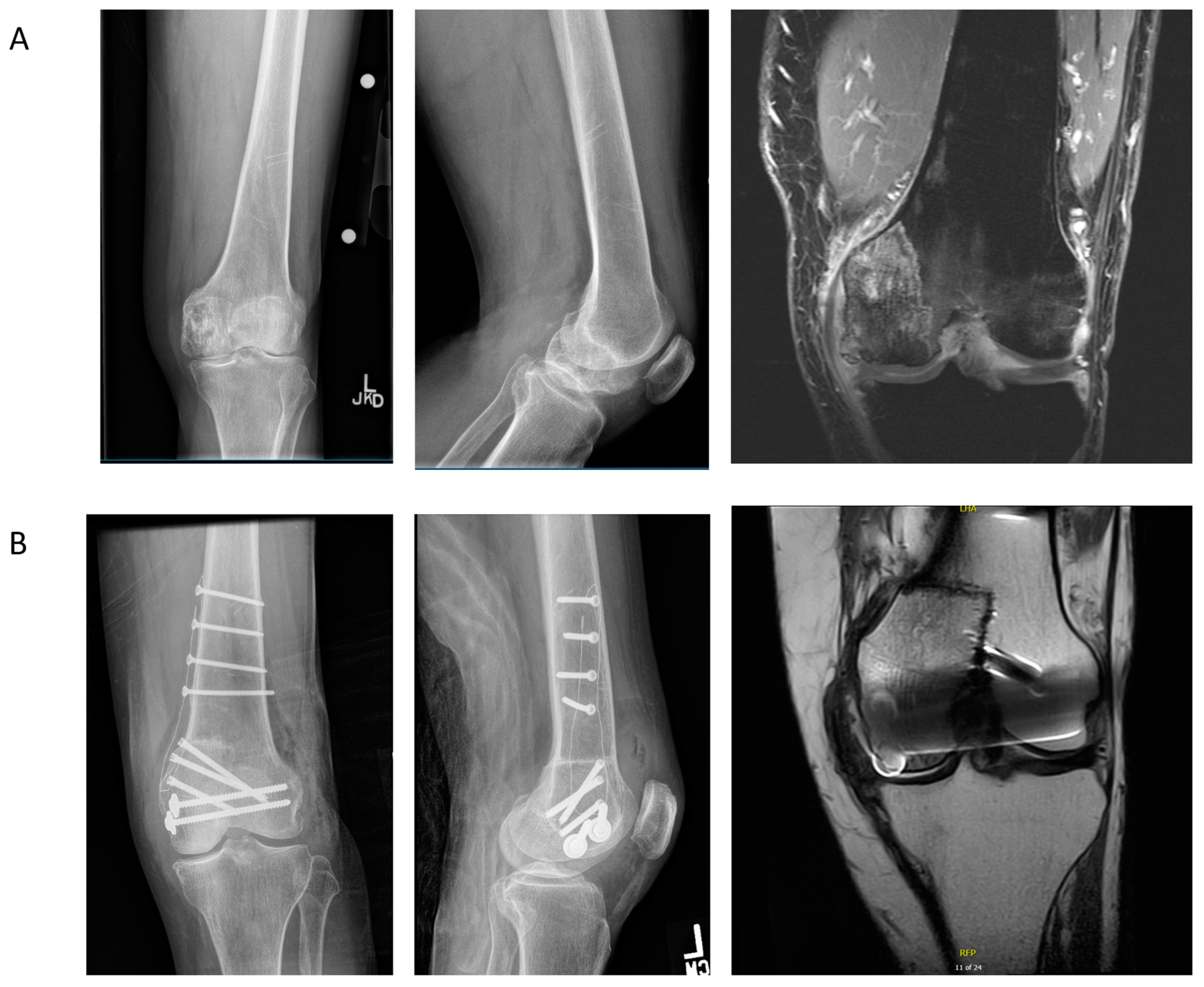 Jcm 11 04959 g003 Jcm 11 04959 g003