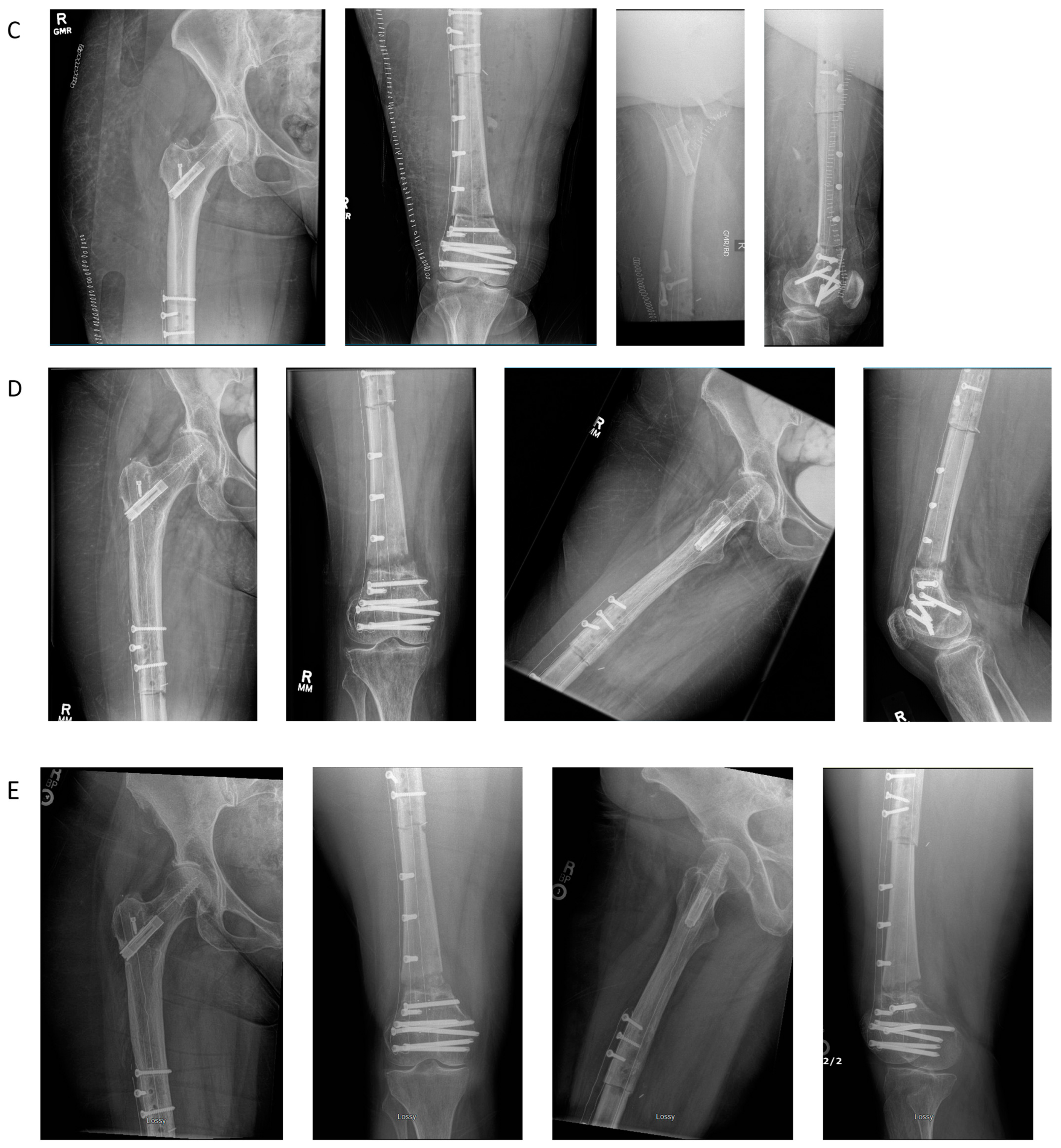 Jcm 11 04959 g004b Jcm 11 04959 g004b