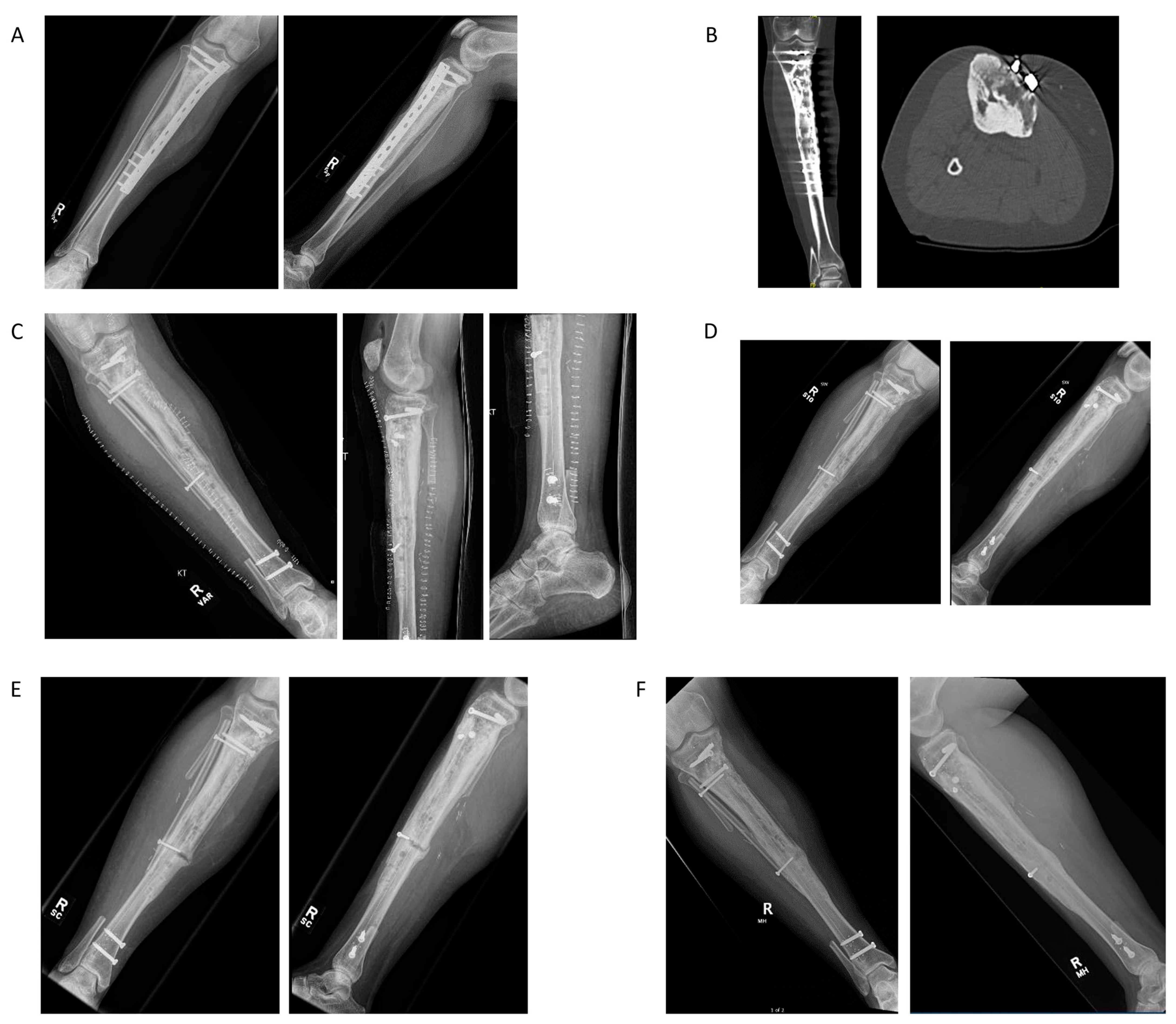 Jcm 11 04959 g006 Jcm 11 04959 g006