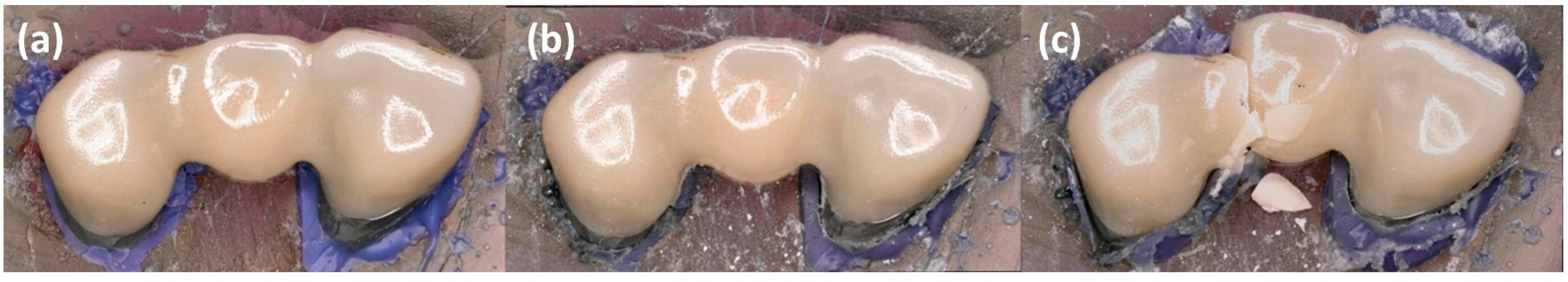 Jcm 11 04982 g004 Jcm 11 04982 g004