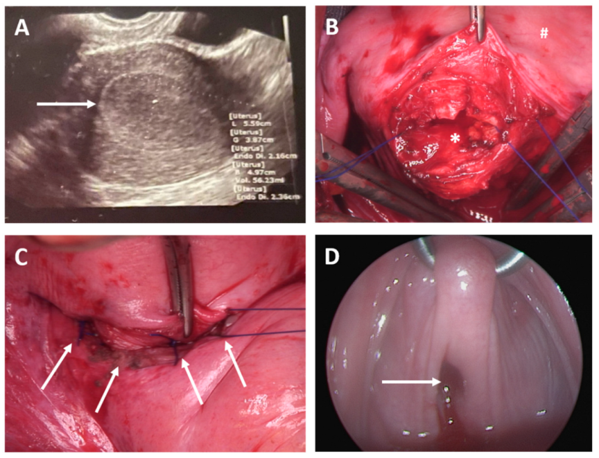 Jcm 11 05026 g003 550