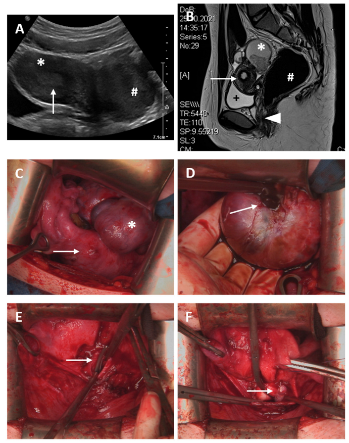 Jcm 11 05026 g004a 550
