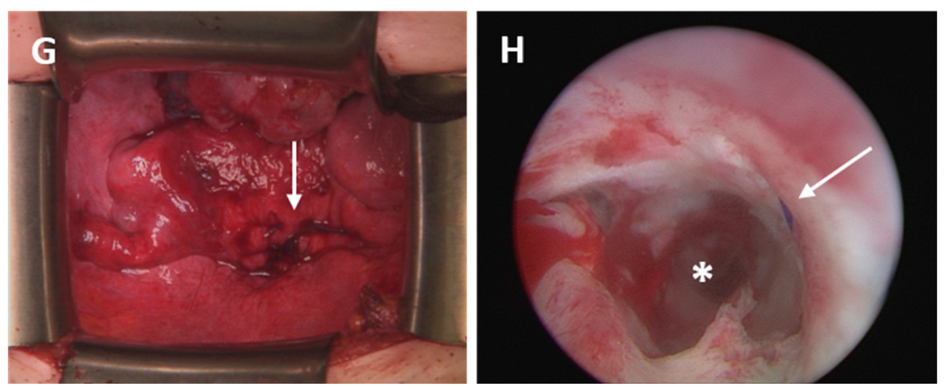 Jcm 11 05026 g004b 550