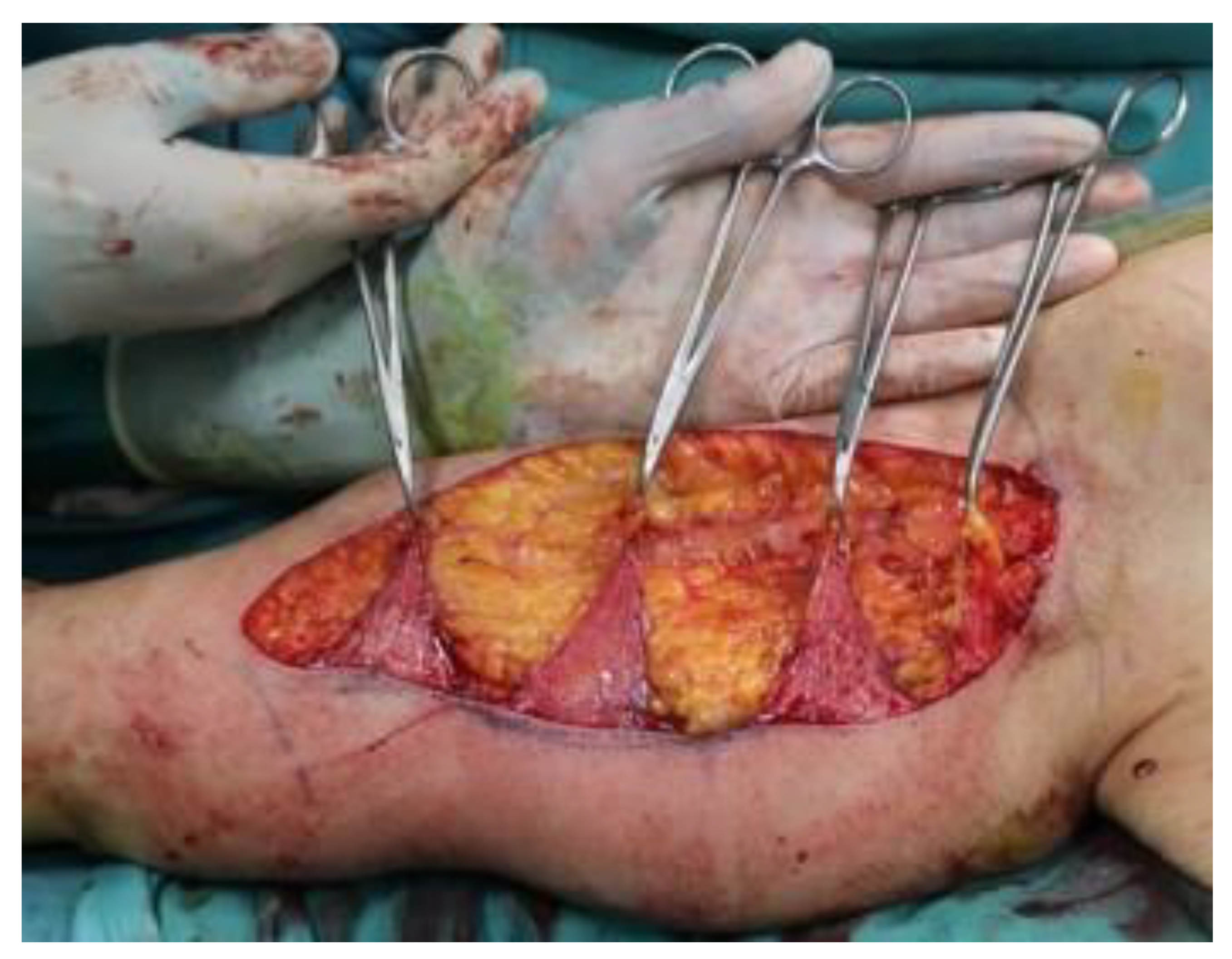 Jcm 11 05038 g002 550