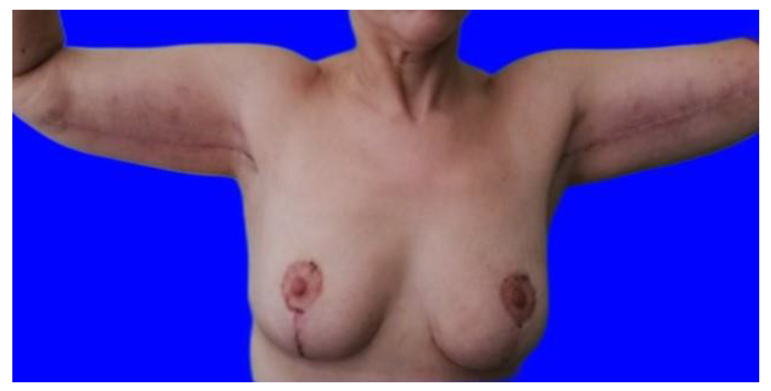 Jcm 11 05038 g004 550