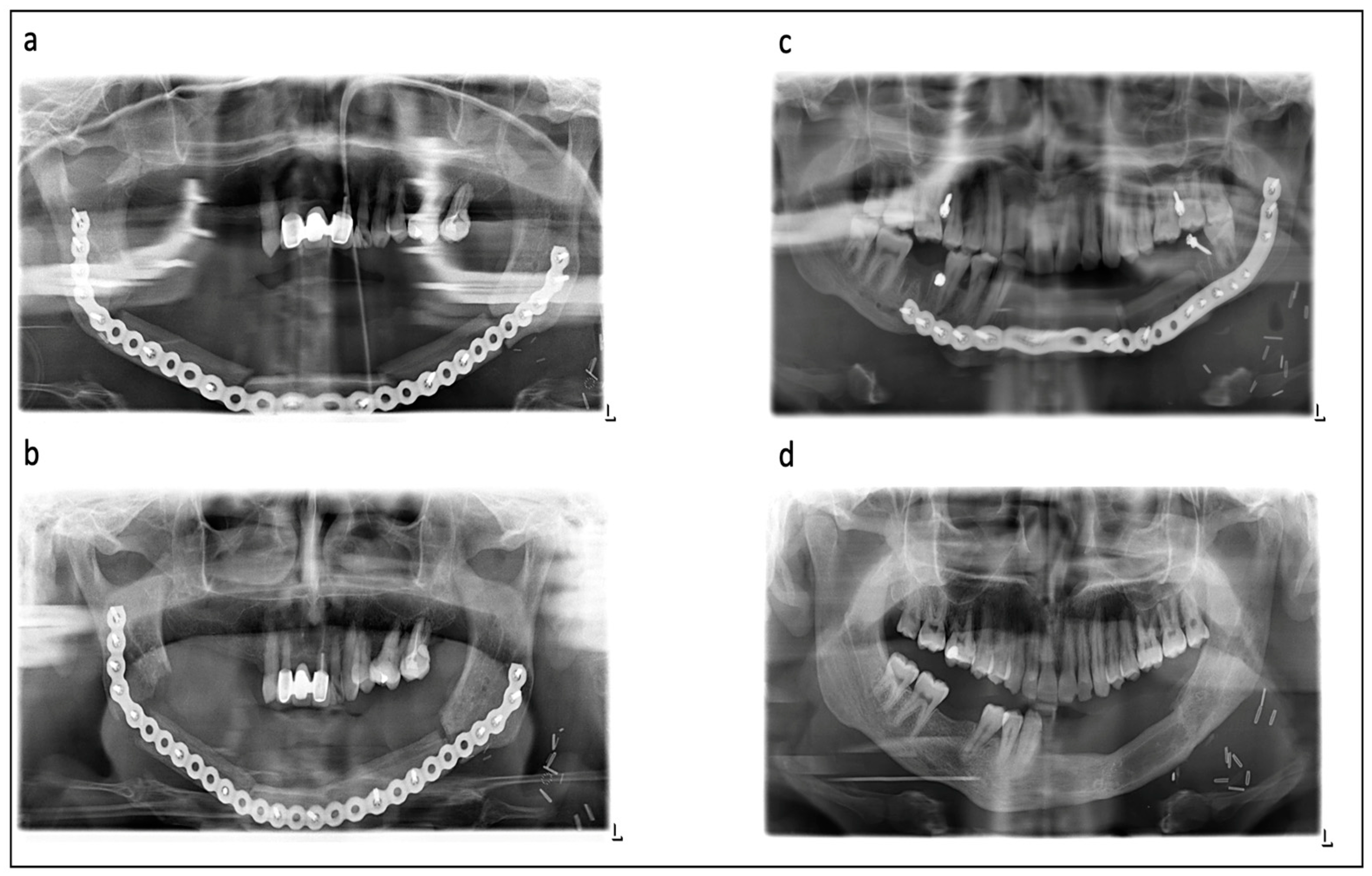 Jcm 11 05041 g001 550