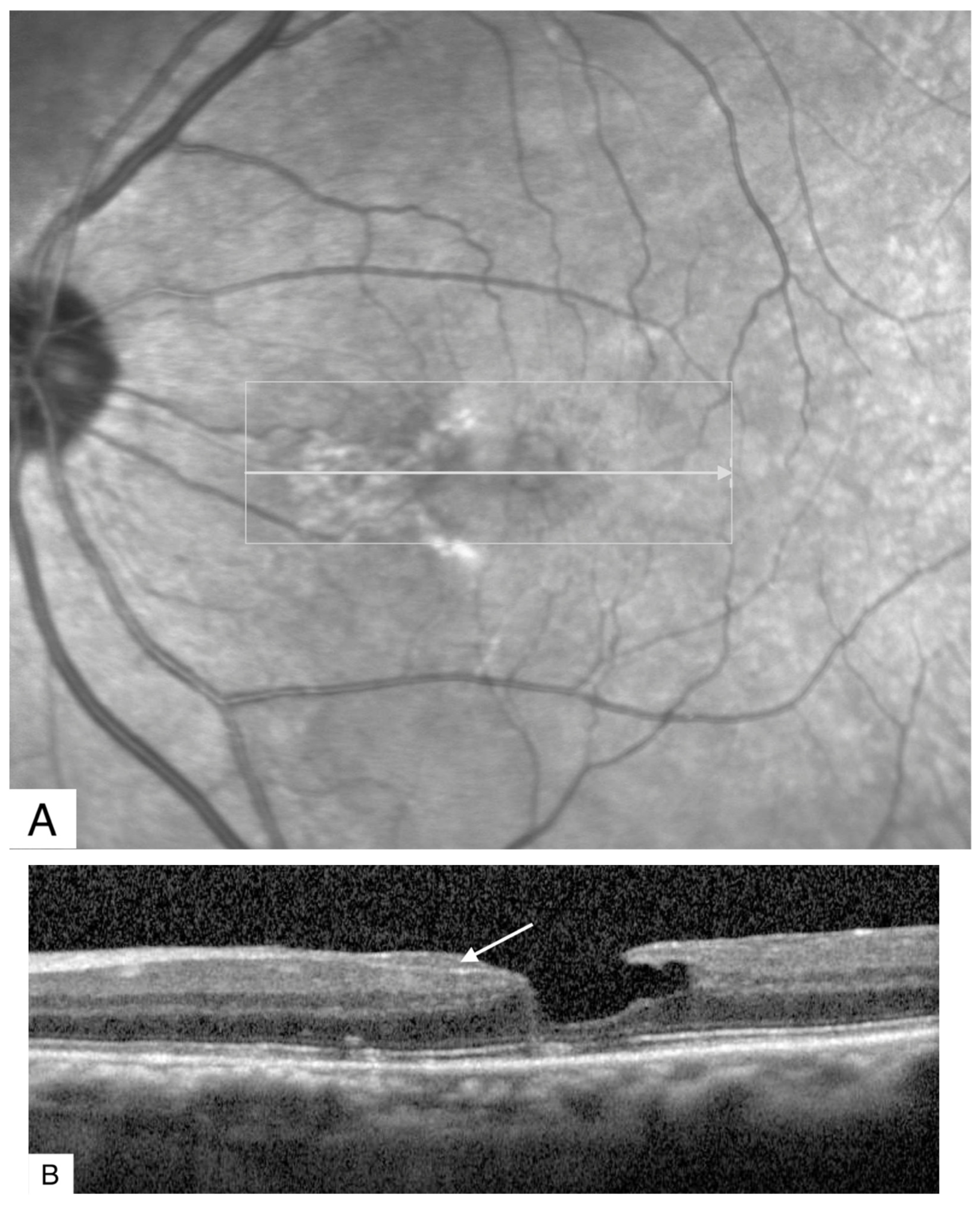 Jcm 11 05046 g003 Jcm 11 05046 g003