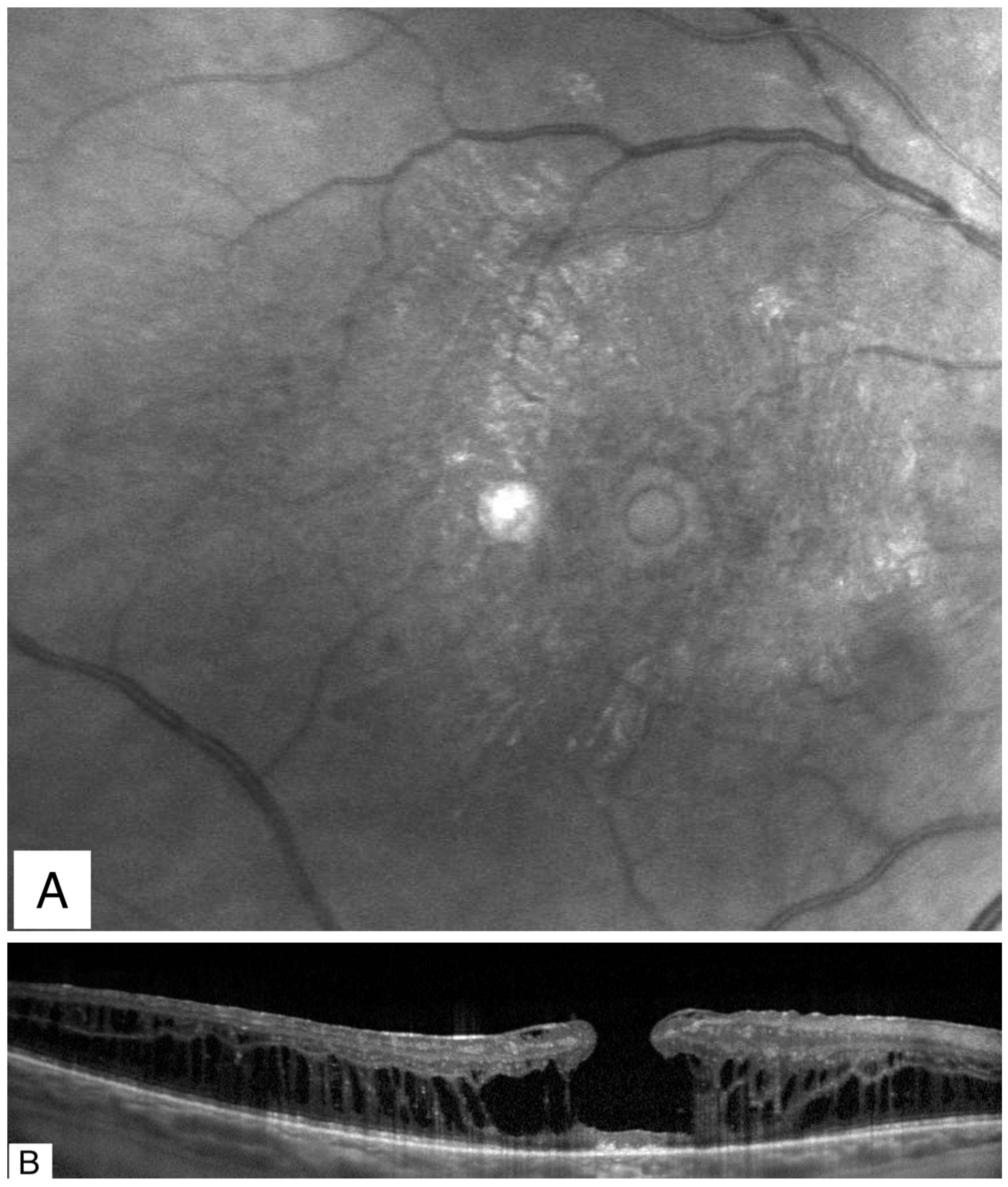 Jcm 11 05046 g004 Jcm 11 05046 g004