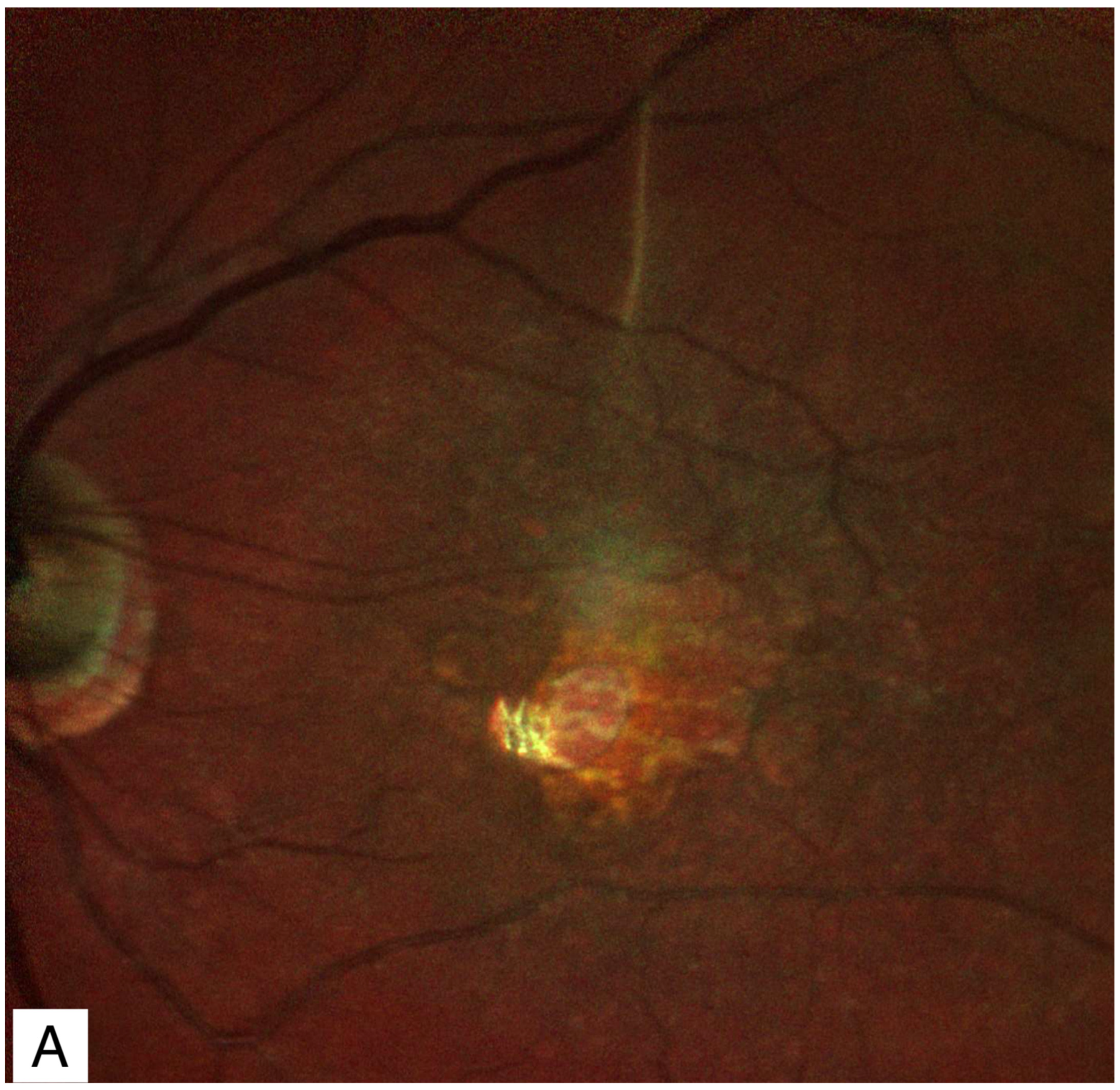 Jcm 11 05046 g005a Jcm 11 05046 g005a