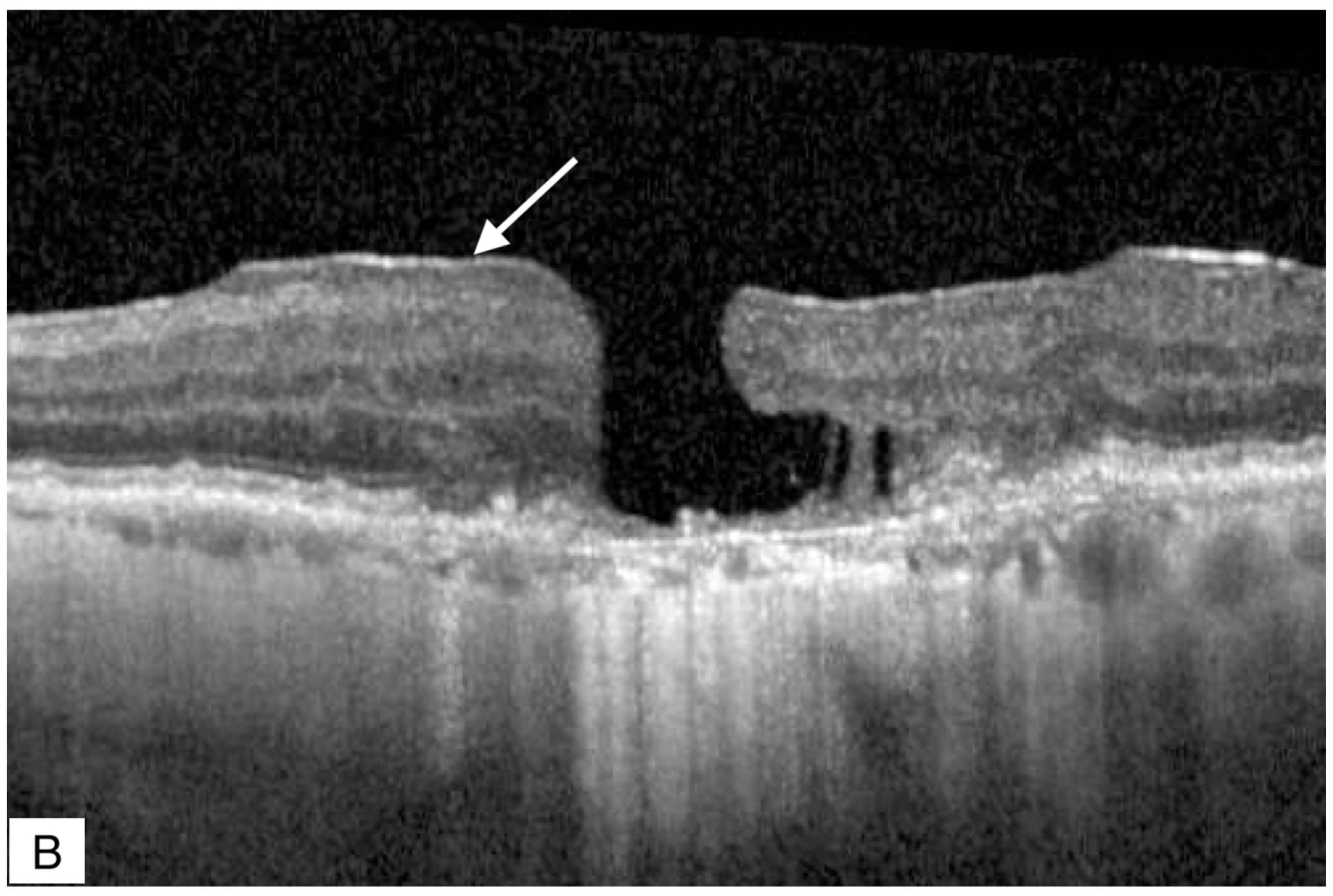Jcm 11 05046 g005b Jcm 11 05046 g005b