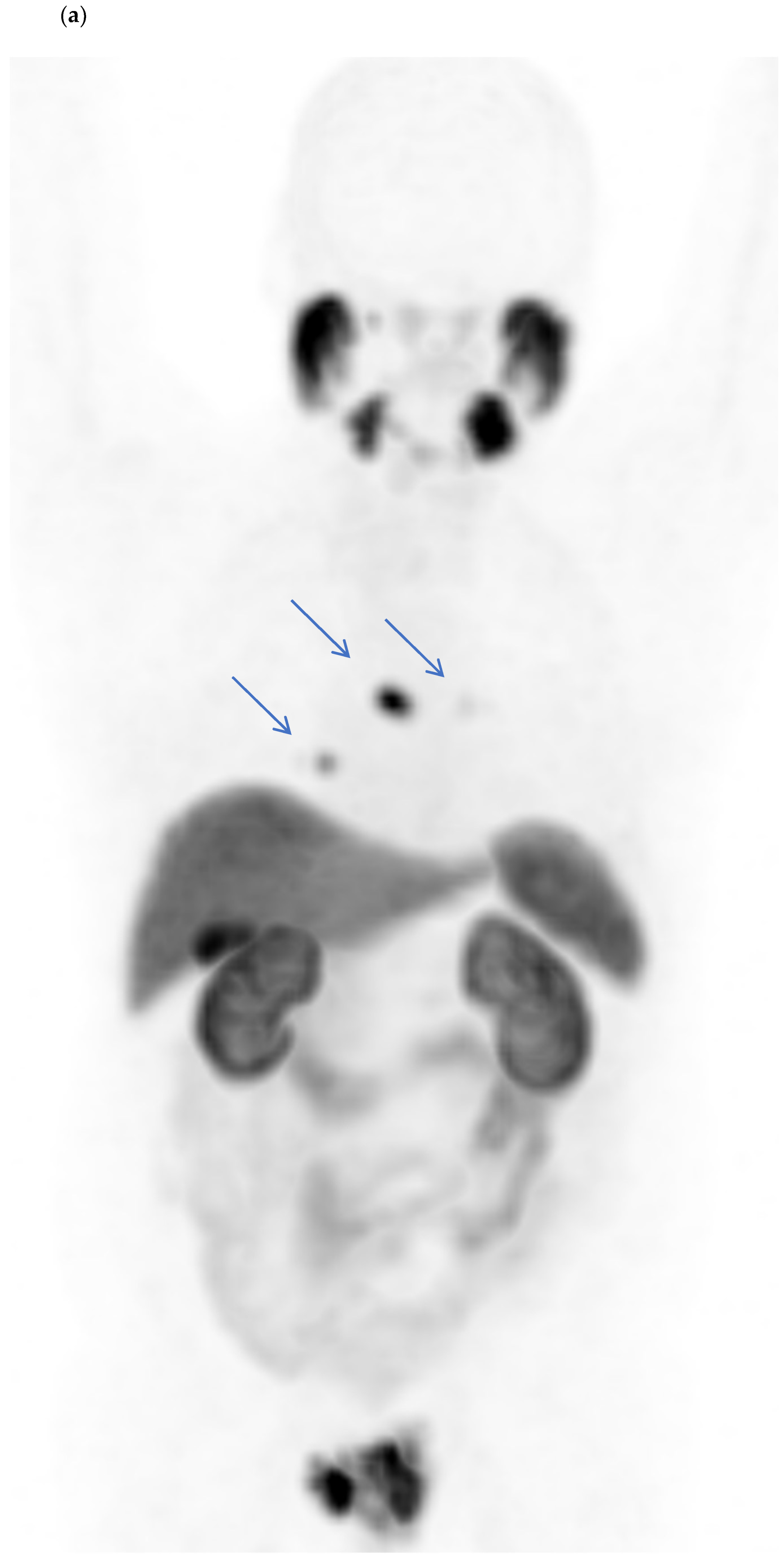 Jcm 11 05064 g003a 550