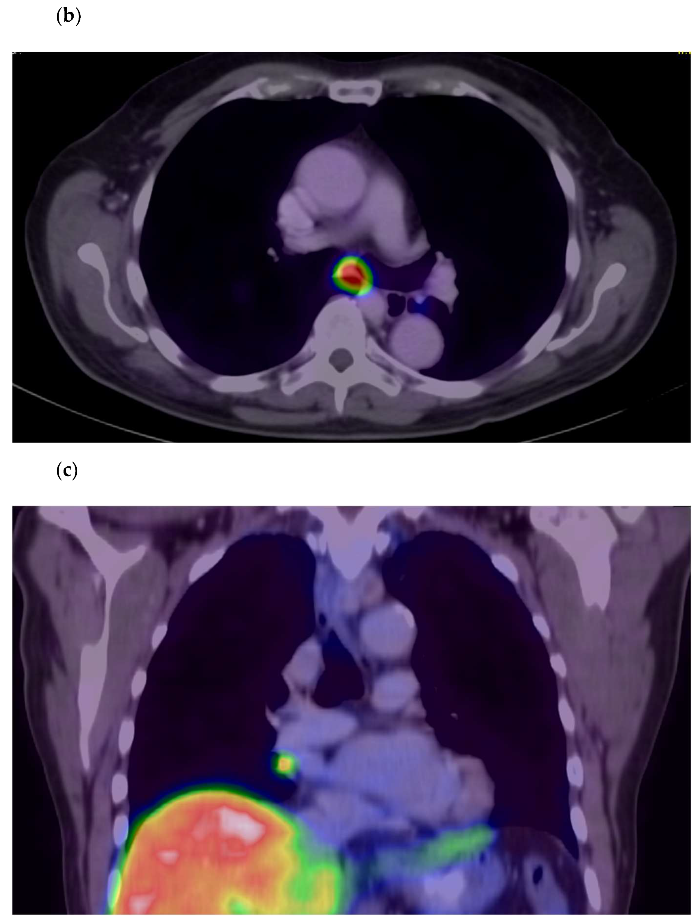 Jcm 11 05064 g003b 550