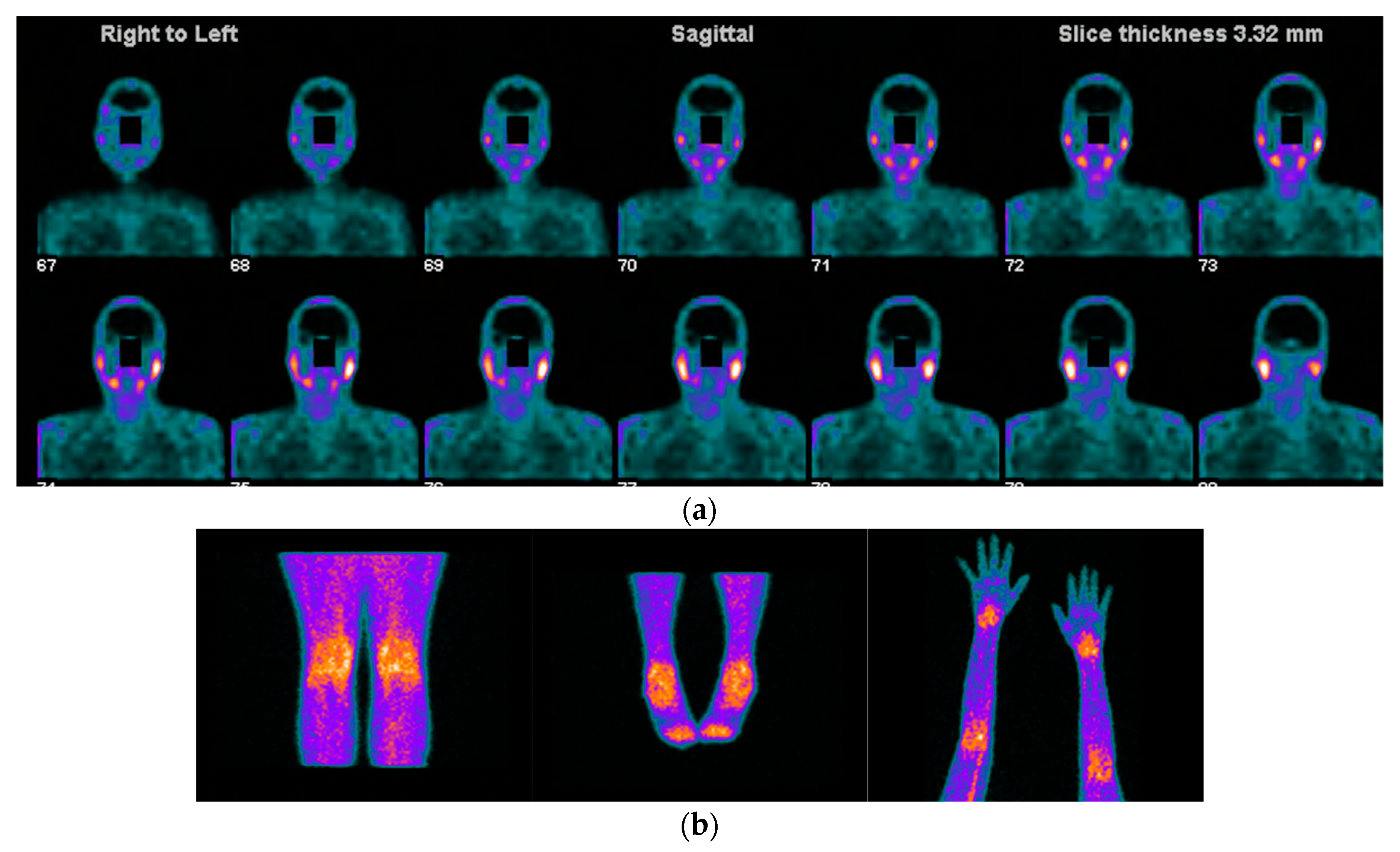 Jcm 11 05227 g003 Jcm 11 05227 g003