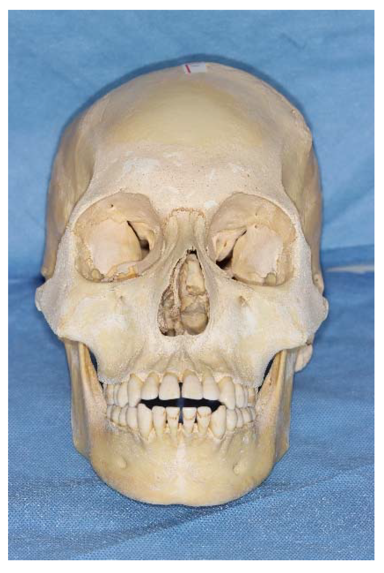 Jcm 11 05229 g001 550