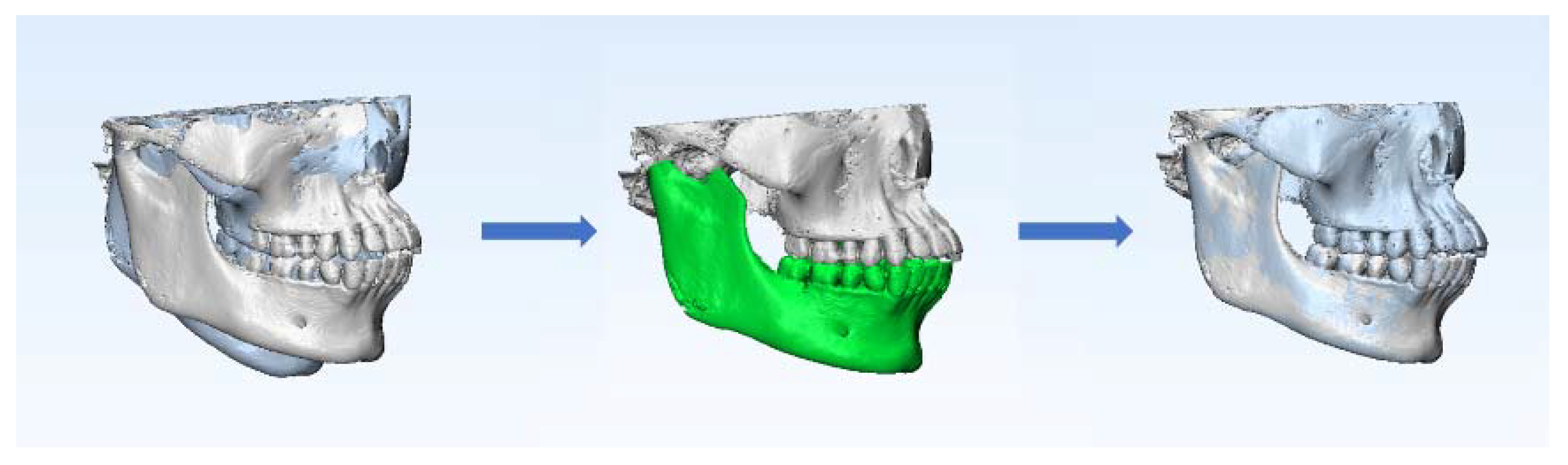 Jcm 11 05229 g003 550