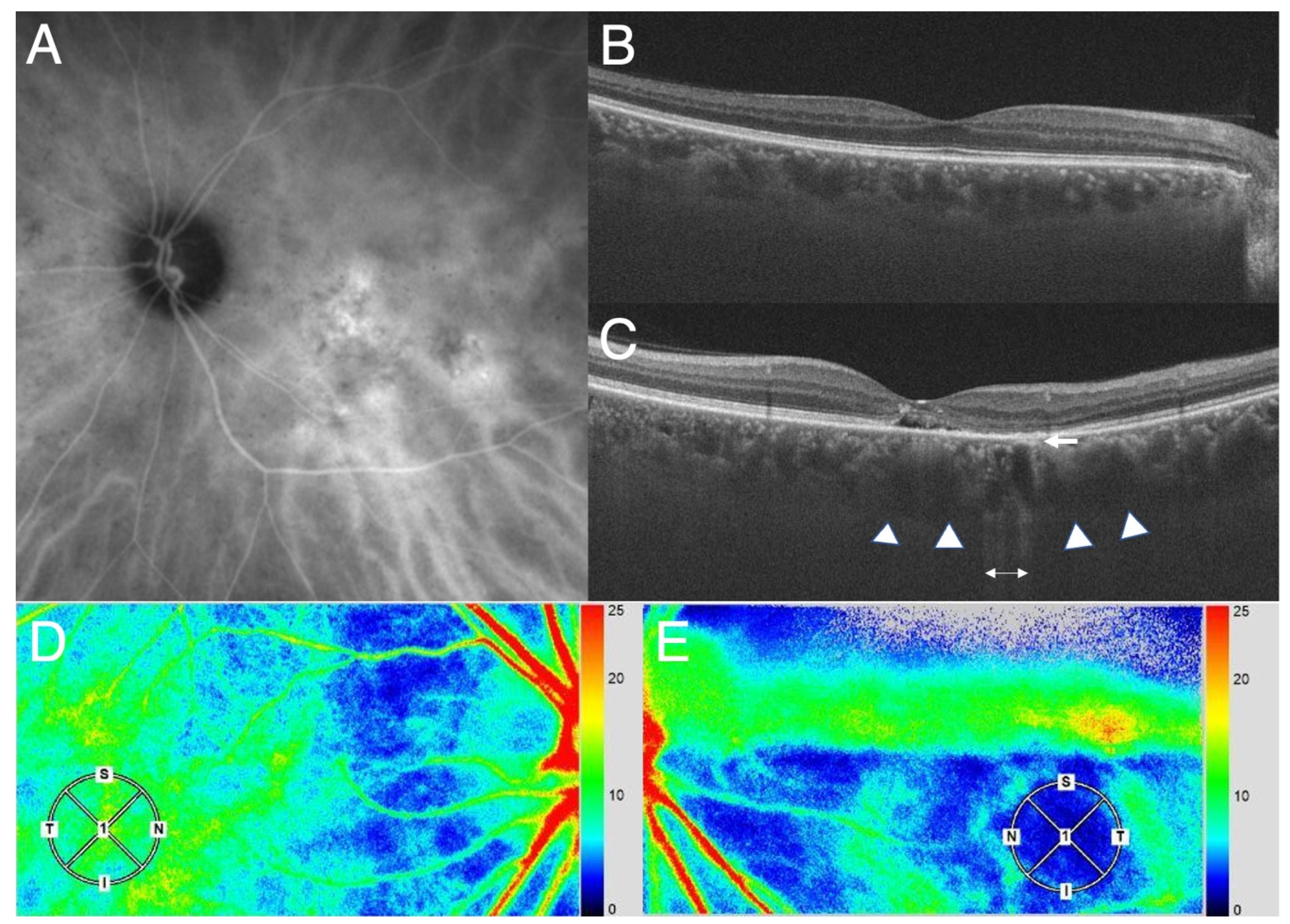 Jcm 11 05247 g001 550