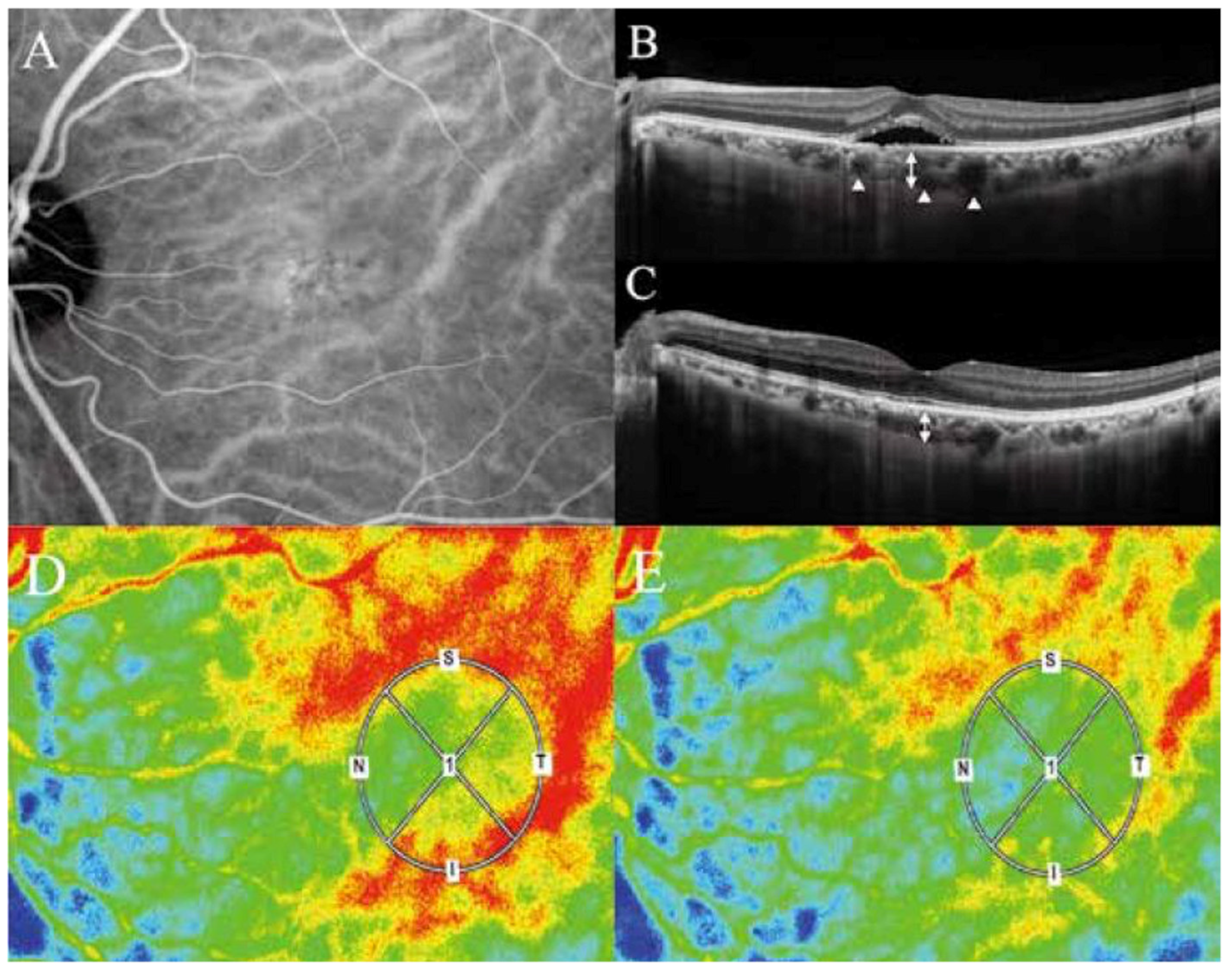 Jcm 11 05247 g002 550