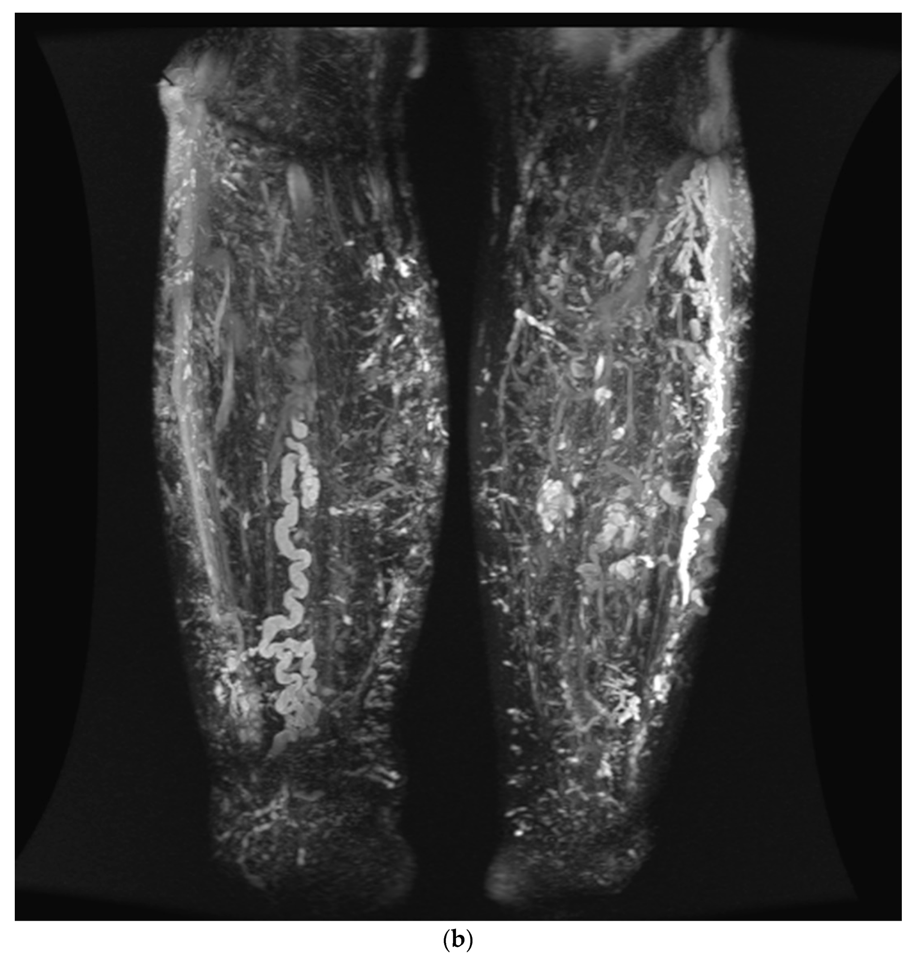 Jcm 11 05255 g002b 550