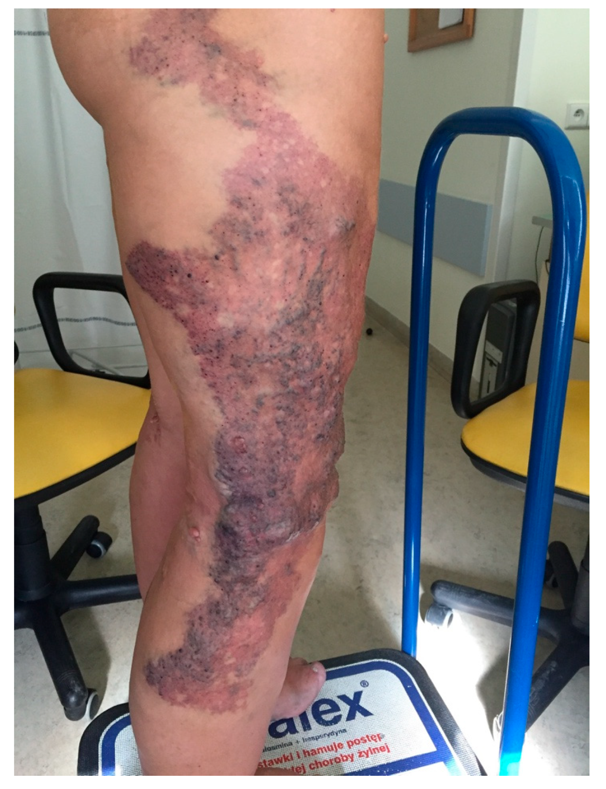 Jcm 11 05255 g003 550