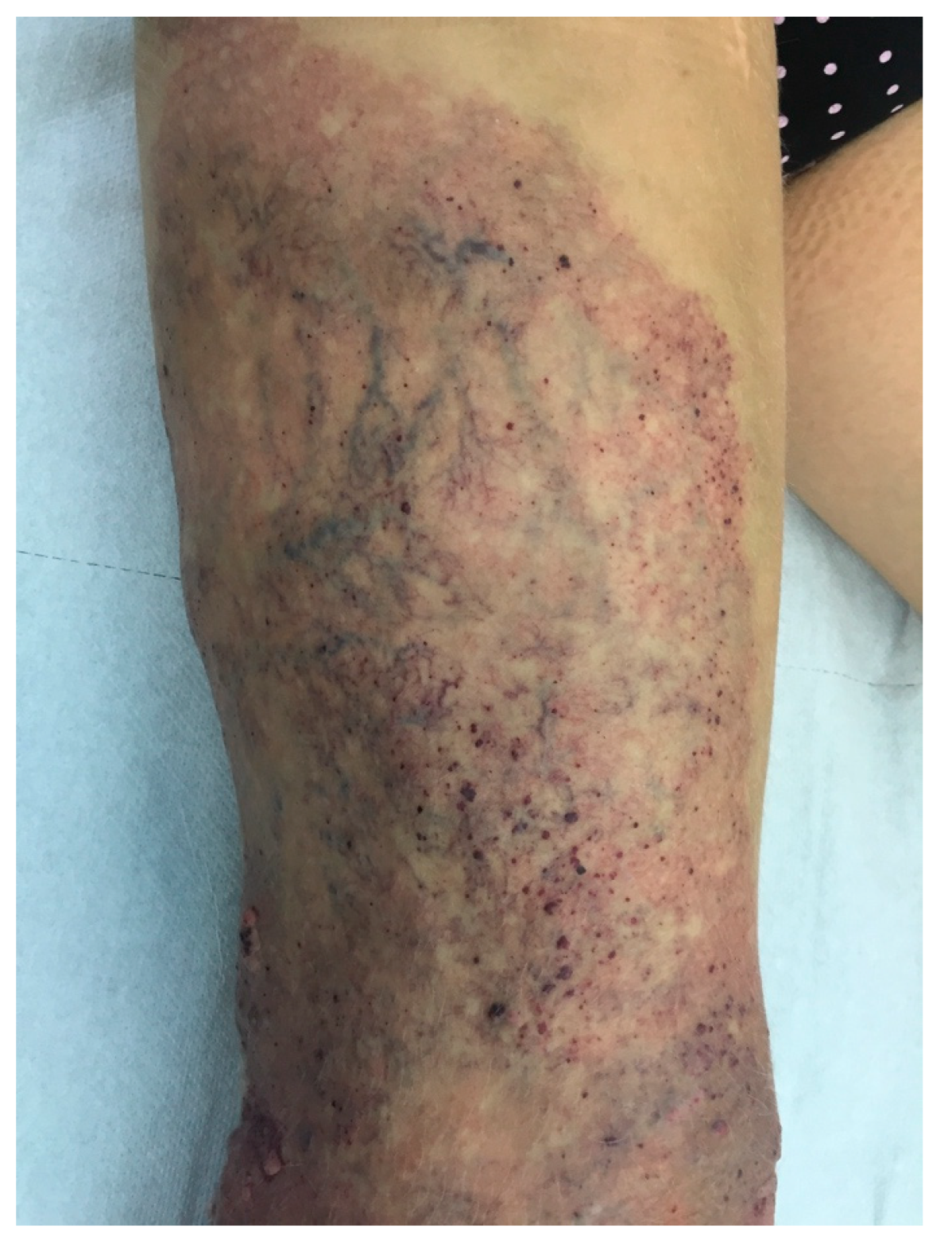 Jcm 11 05255 g004 550