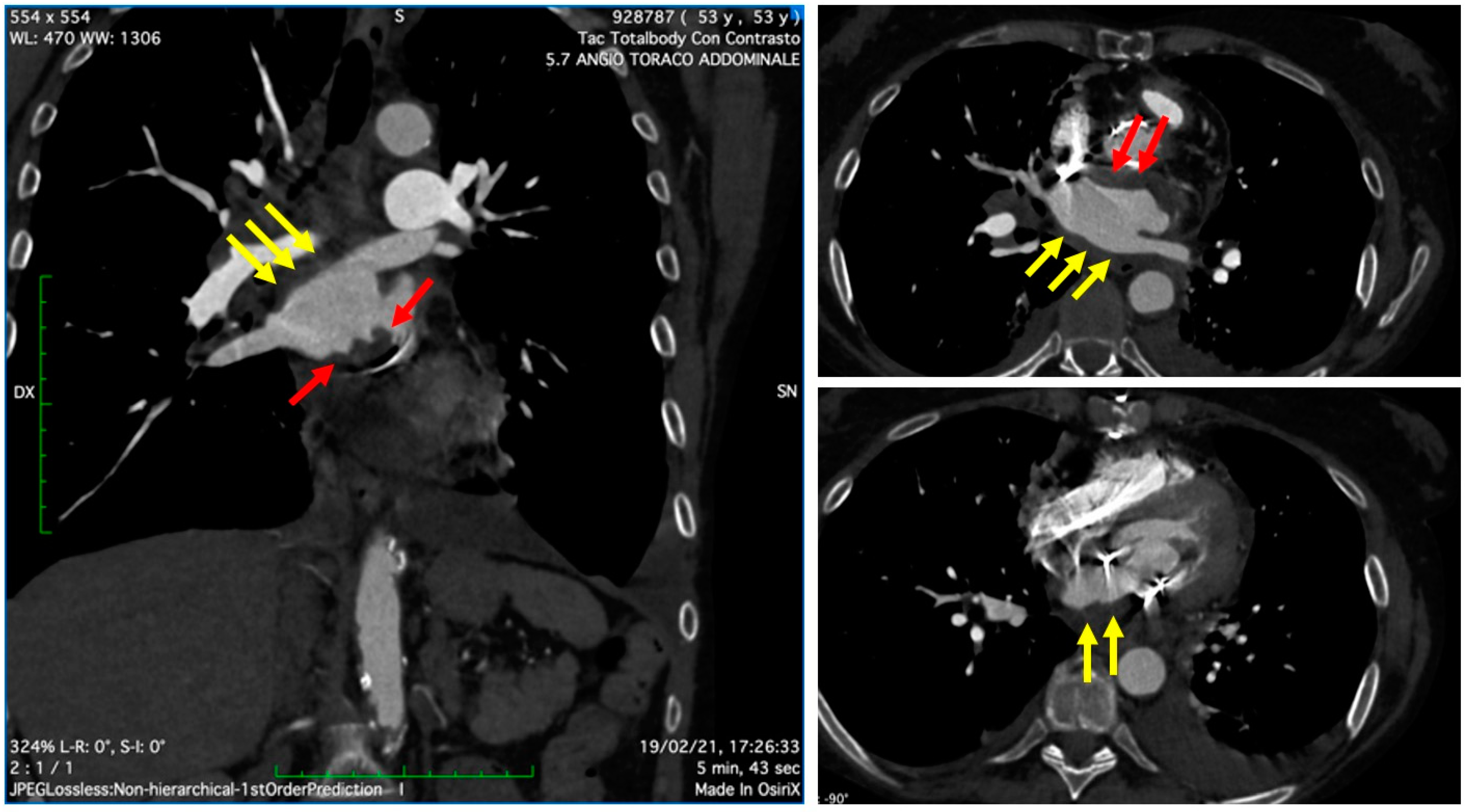 Jcm 11 05277 g002 550