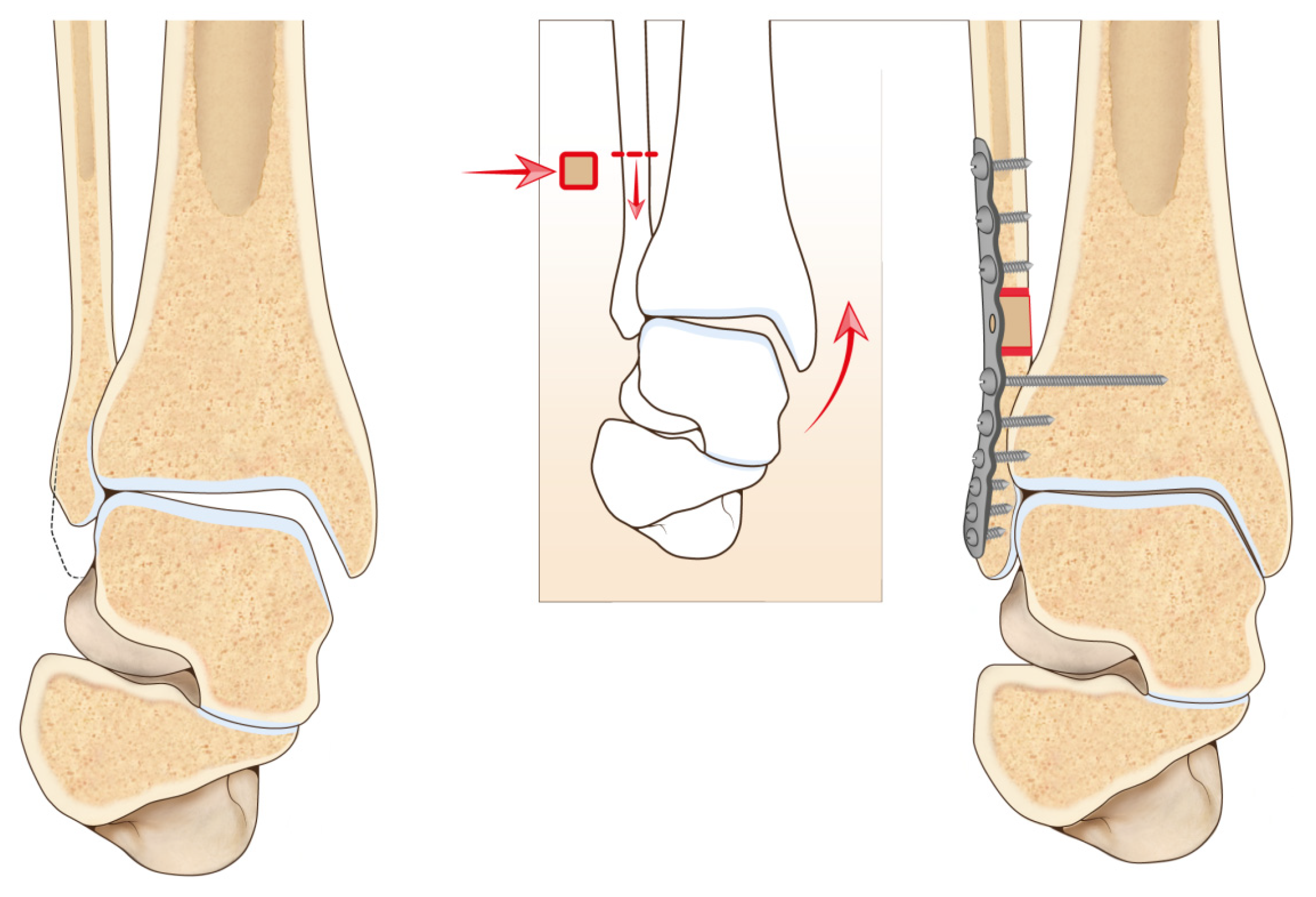 Jcm 11 05288 g002 Jcm 11 05288 g002