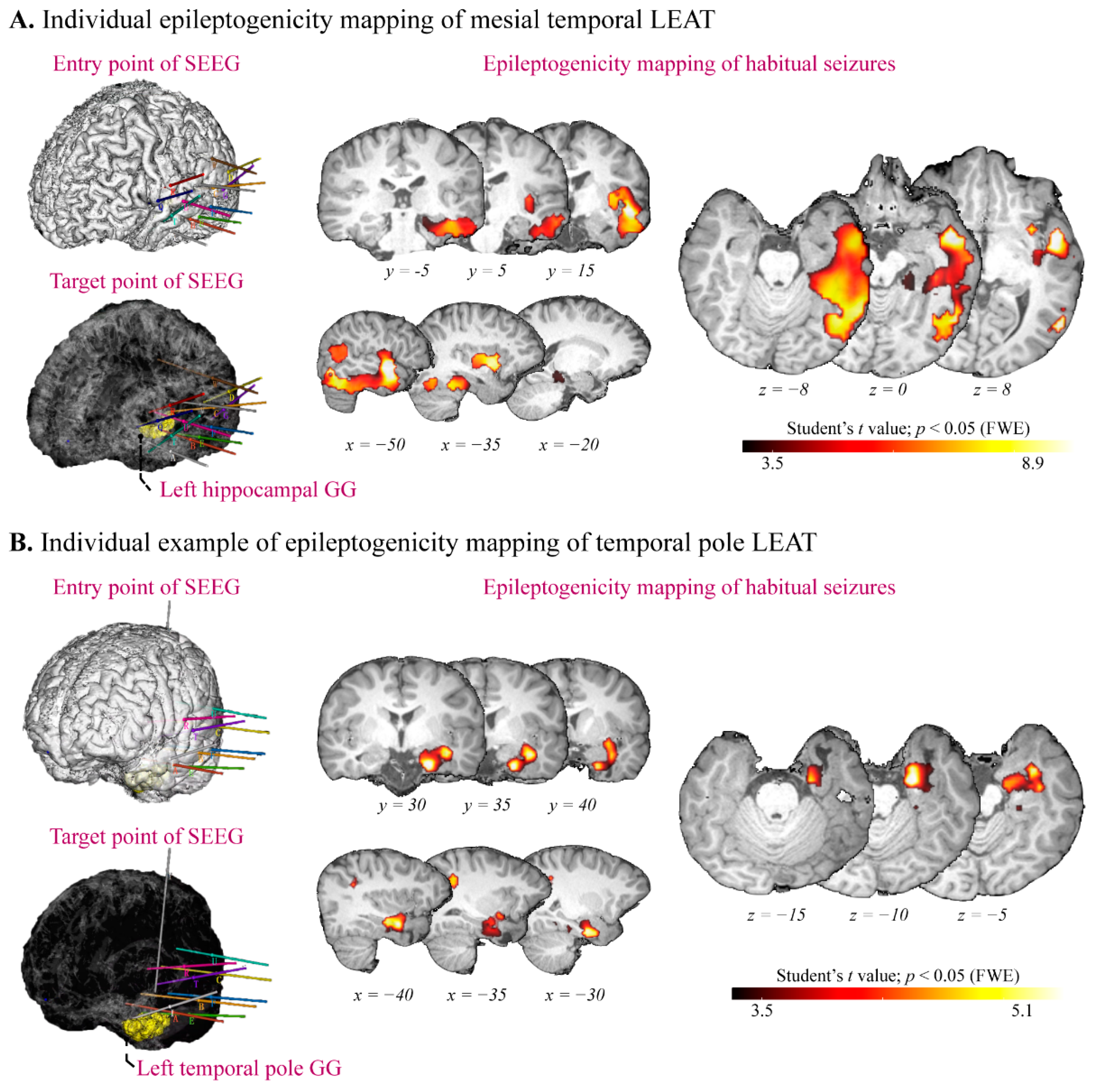Jcm 11 05309 g004 550