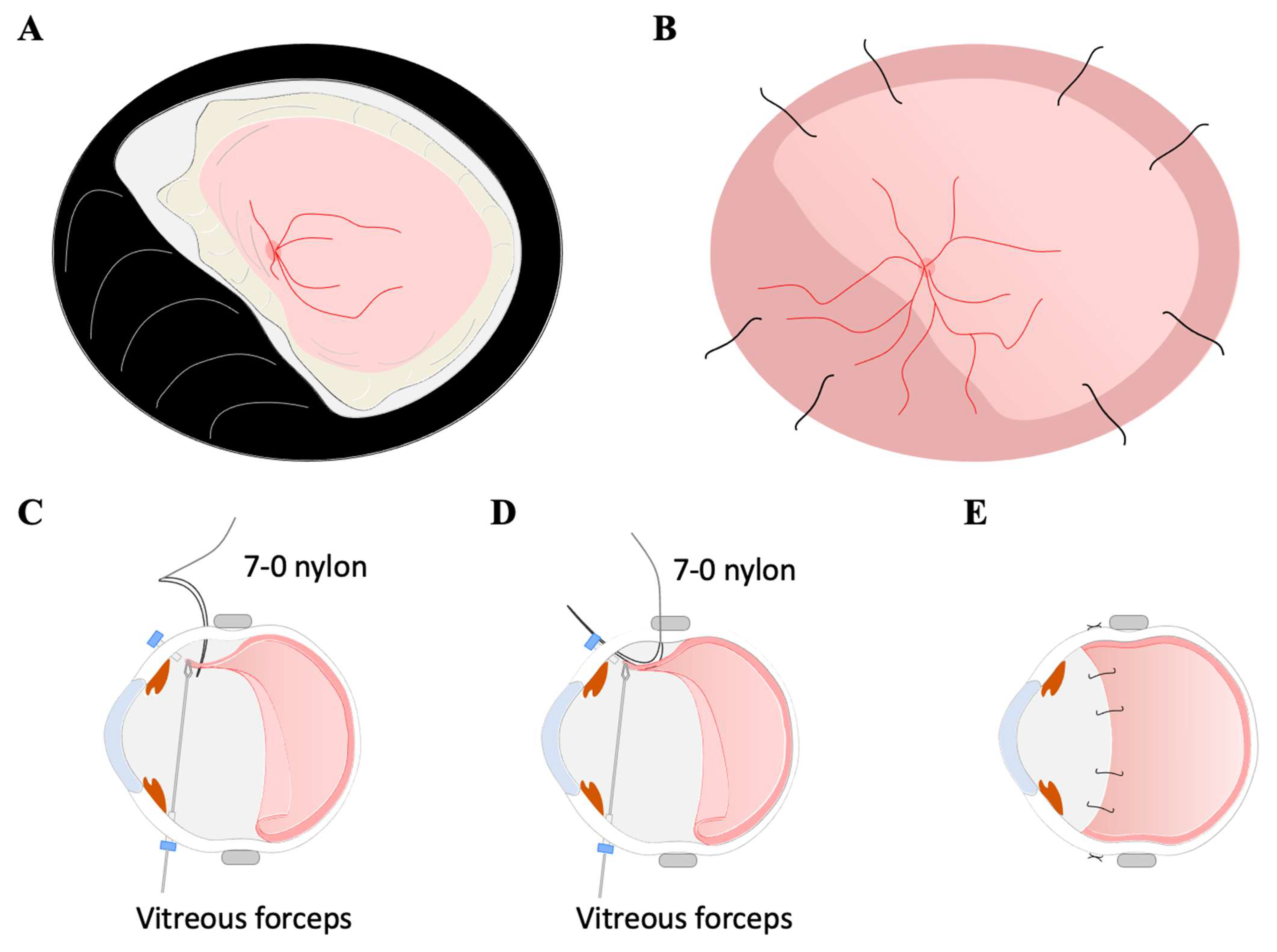 Jcm 11 05344 g004 550
