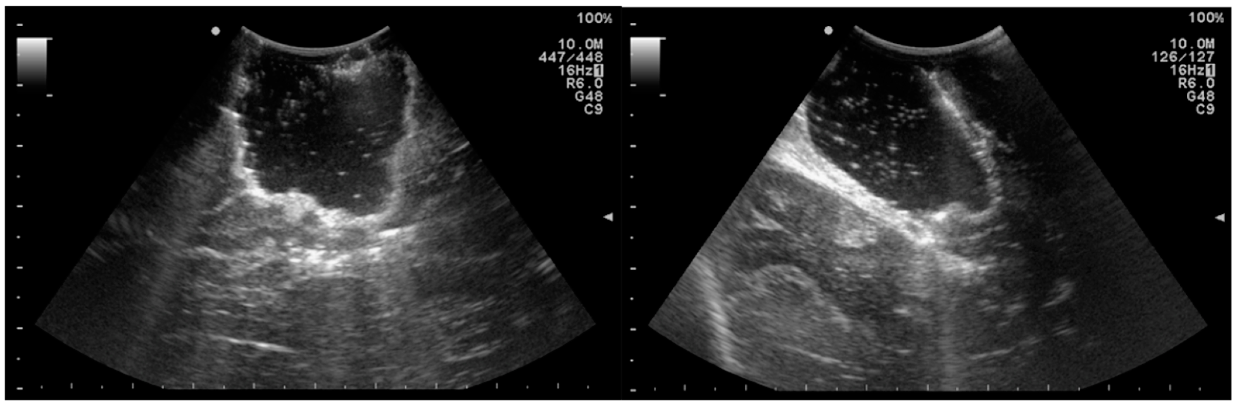 Jcm 11 05354 g002 550