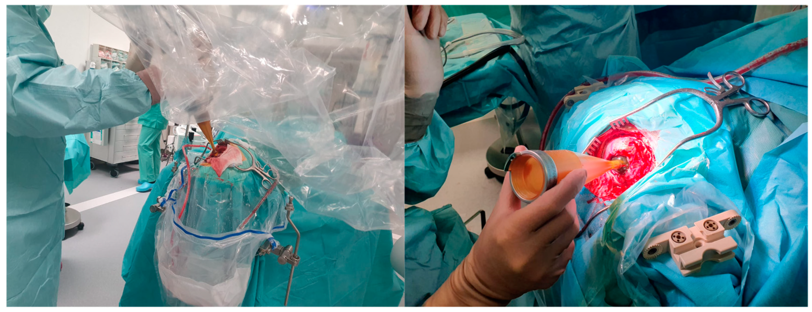 Jcm 11 05354 g003 550