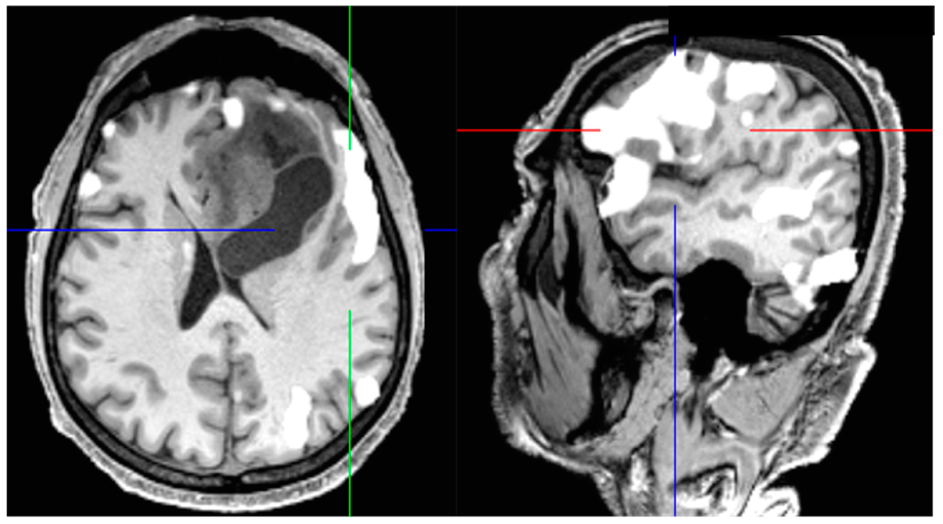 Jcm 11 05354 g005 550