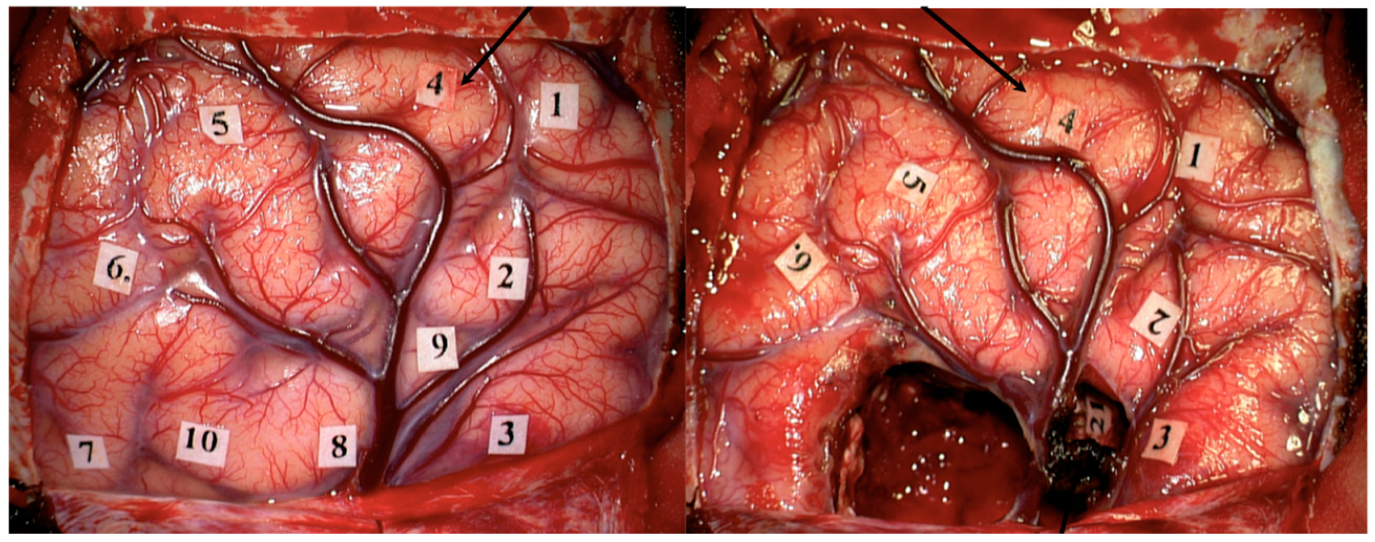 Jcm 11 05354 g008 550