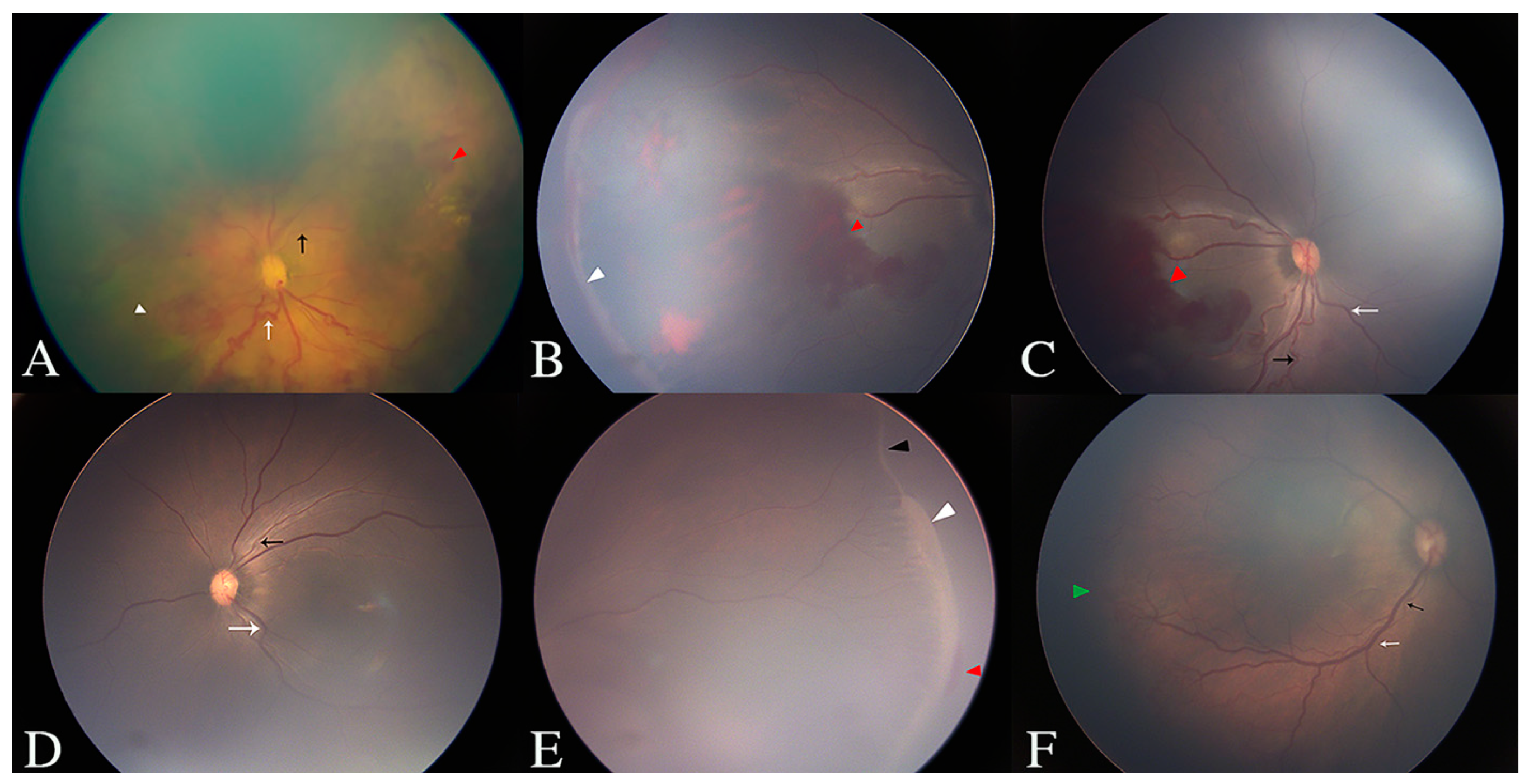 Jcm 11 05361 g001 550