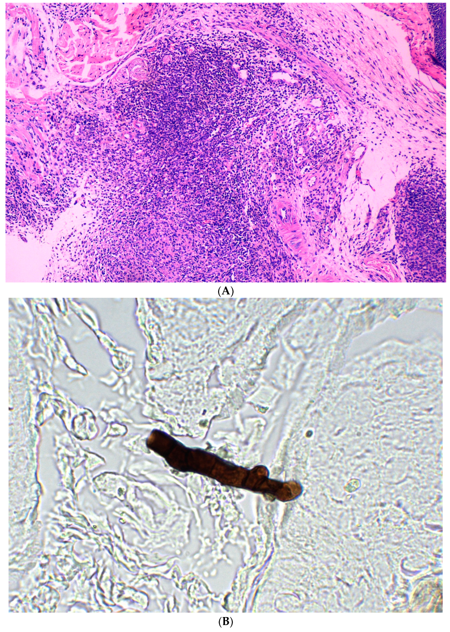 Jcm 11 05393 g003 Jcm 11 05393 g003