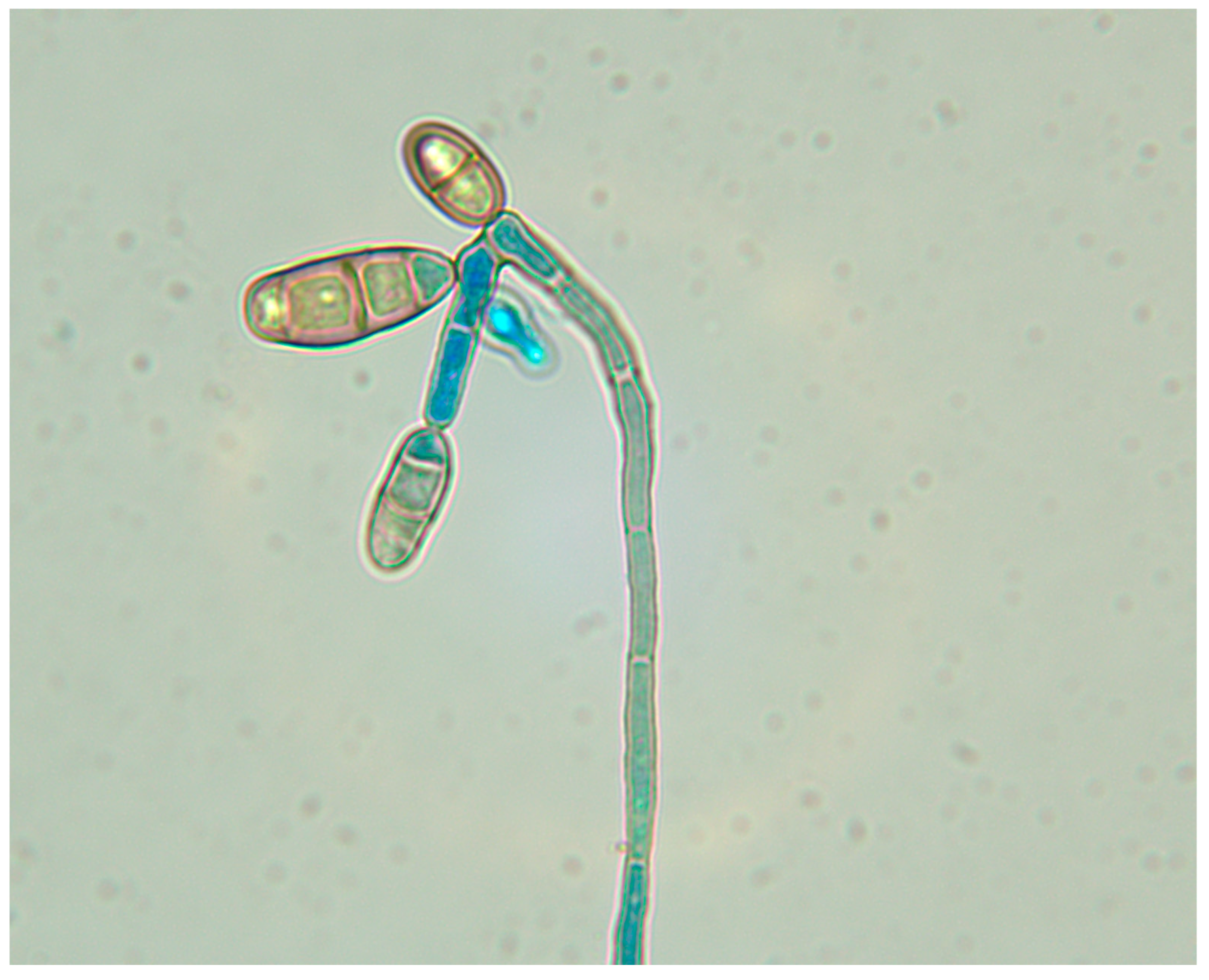 Jcm 11 05393 g005 Jcm 11 05393 g005