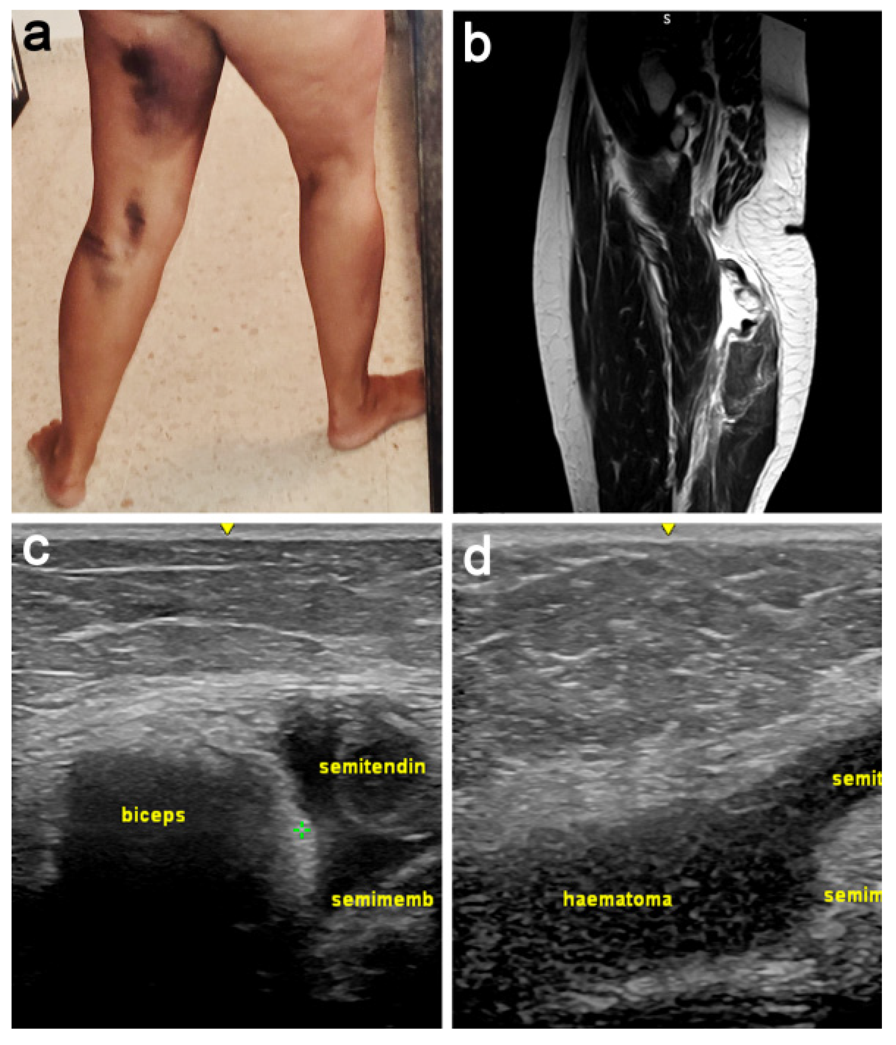 Jcm 11 05443 g001 Jcm 11 05443 g001