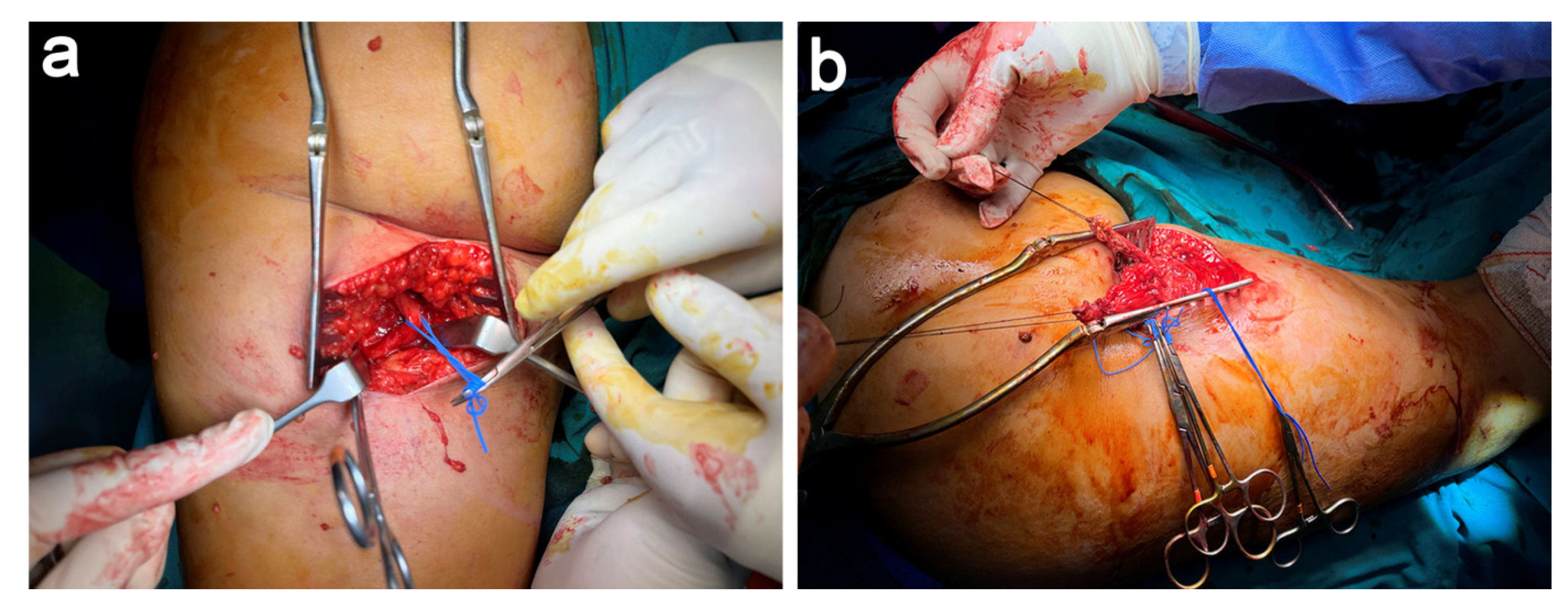 Jcm 11 05443 g003 Jcm 11 05443 g003