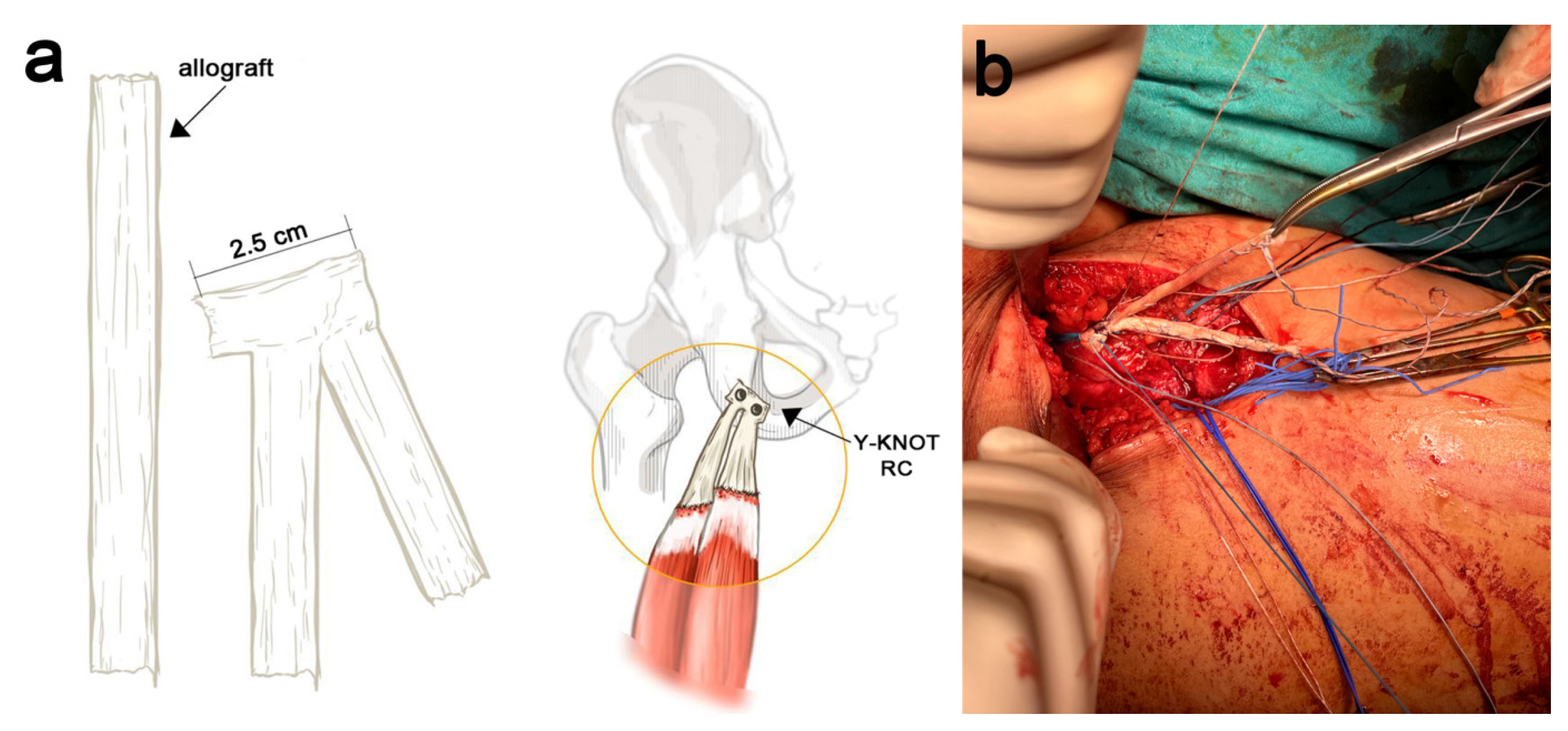 Jcm 11 05443 g004 Jcm 11 05443 g004
