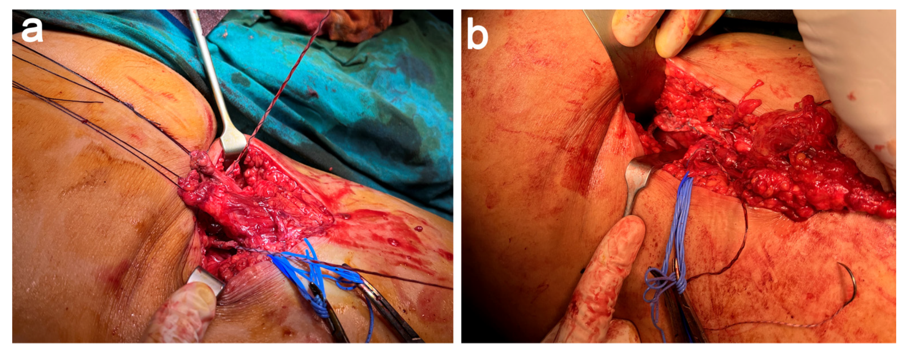 Jcm 11 05443 g005 Jcm 11 05443 g005