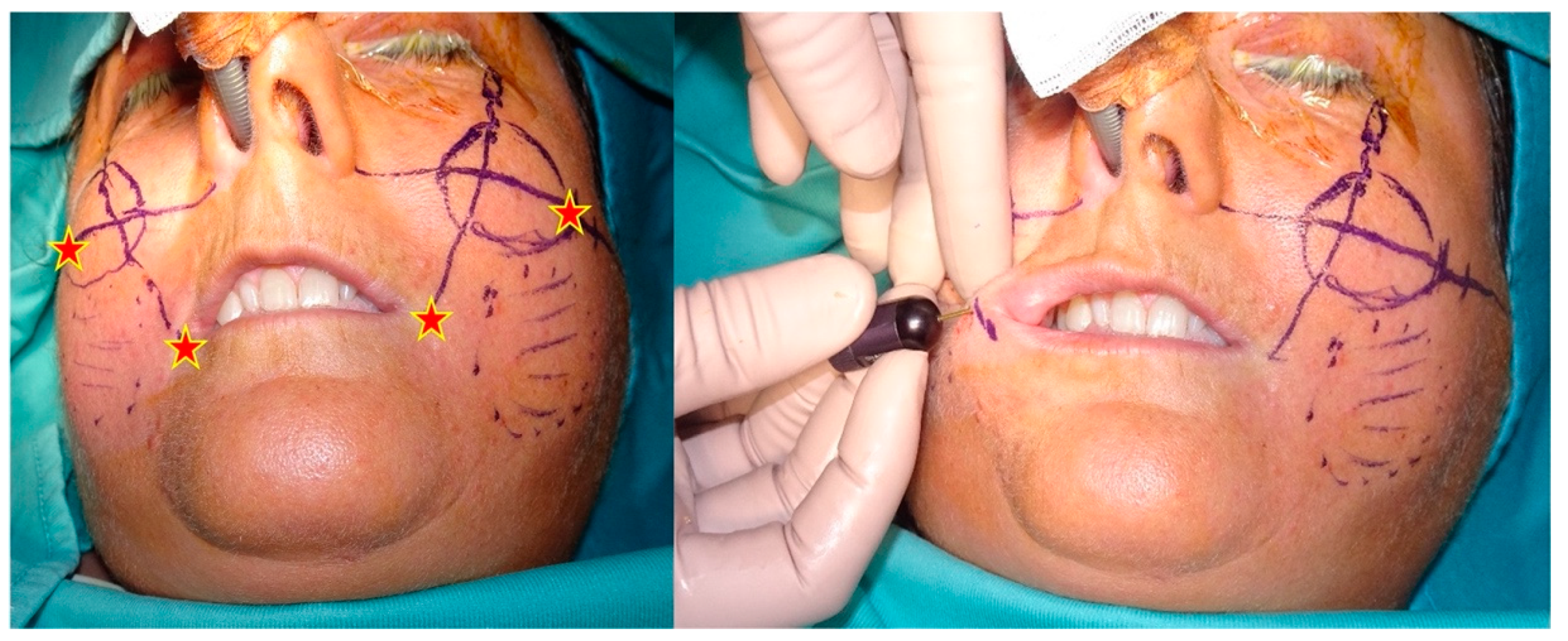 Jcm 11 05489 g002 550