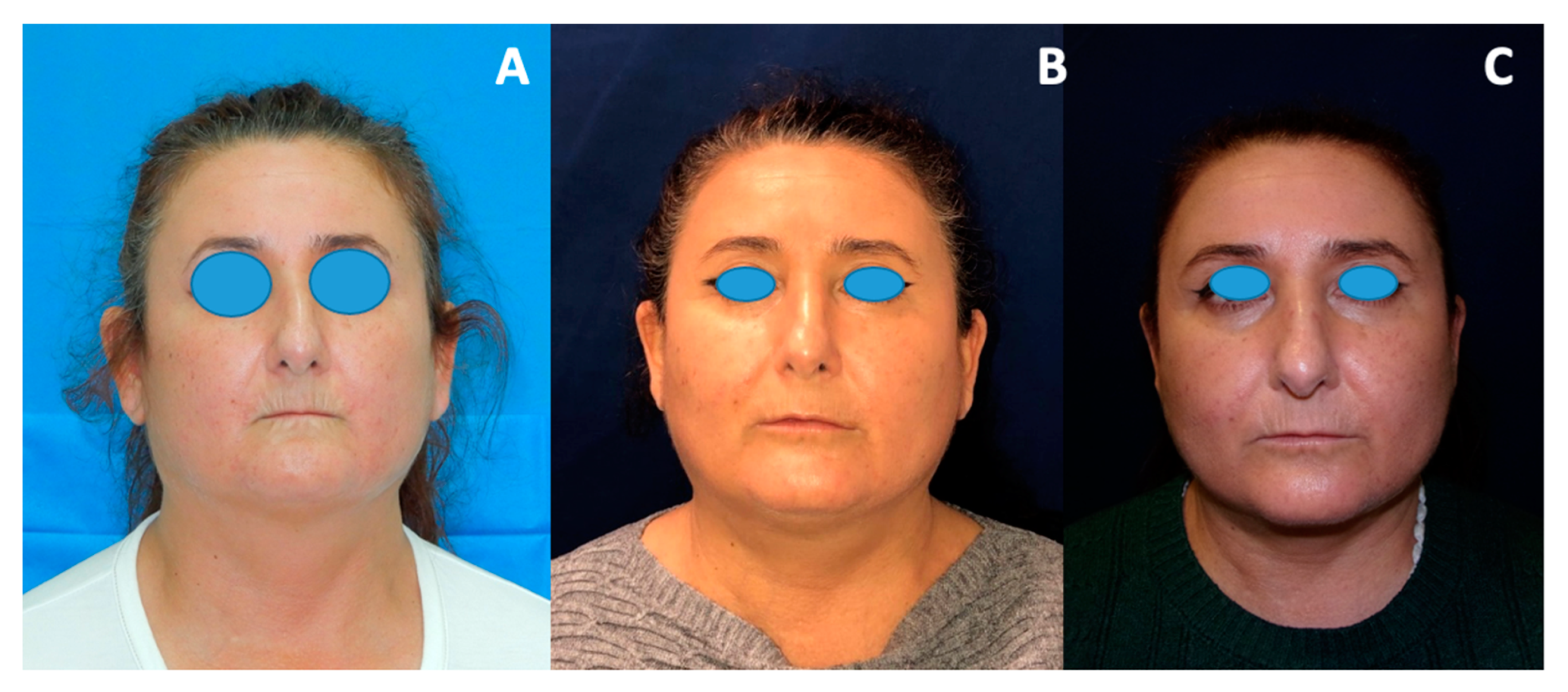 Jcm 11 05489 g004 550