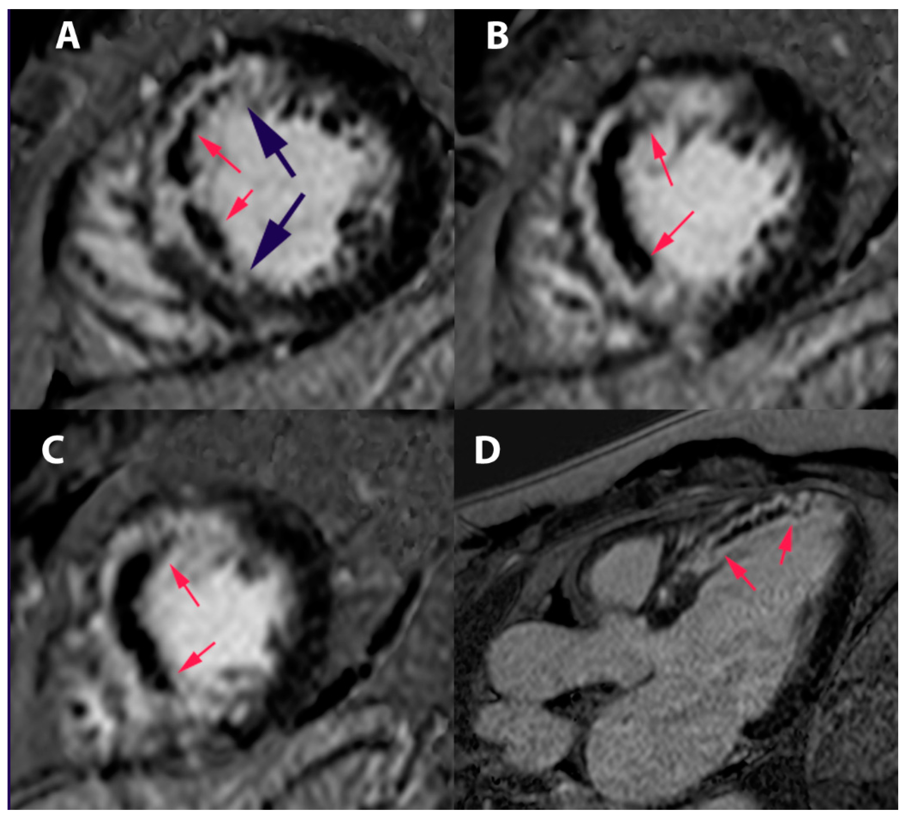 Jcm 11 05497 g013 Jcm 11 05497 g013